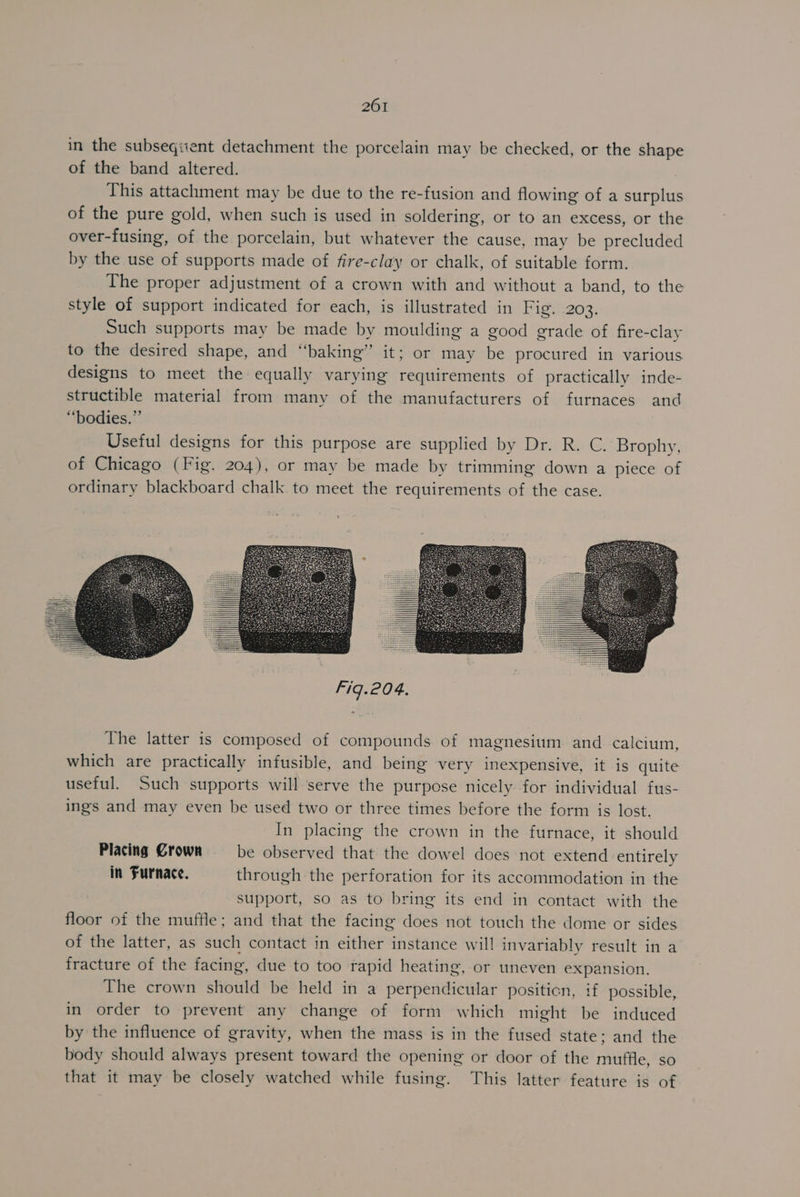 in the subseqiient detachment the porcelain may be checked, or the shape of the band altered. This attachment may be due to the re-fusion and flowing of a surplus of the pure gold, when such is used in soldering, or to an excess, or the over-fusing, of the porcelain, but whatever the cause, may be precluded by the use of supports made of fire-clay or chalk, of suitable form. The proper adjustment of a crown with and without a band, to the style of support indicated for each, is illustrated in Fig. 203. Such supports may be made by moulding a good grade of fire-clay to the desired shape, and “baking” it; or may be procured in various designs to meet the equally varying requirements of practically inde- structible material from many of the manufacturers of furnaces and “bodies.” Useful designs for this purpose are supplied by Dr. R. C. Brophy, of Chicago (Fig. 204), or may be made by trimming down a piece of ordinary blackboard chalk to meet the requirements of the case. The latter 1s composed of compounds of magnesium and calcium, which are practically infusible, and being very inexpensive, it is quite useful. Such supports will serve the purpose nicely for individual fus- ings and may even be used two or three times before the form is lost. In placing the crown in the furnace, it should Placing Grown be observed that the dowel does not extend entirely in Furnace. through the perforation for its accommodation in the support, so as to bring its end in contact with the floor of the muffle; and that the facing does not touch the dome or sides of the latter, as such contact in either instance will invariably result in a fracture of the facing, due to too rapid heating, or uneven expansion. The crown should be held in a perpendicular position, if possible, in order to prevent any change of form which might be induced by the influence of gravity, when the mass is in the fused state; and the body should always present toward the opening or door of the muffle, so that it may be closely watched while fusing. This latter feature is of