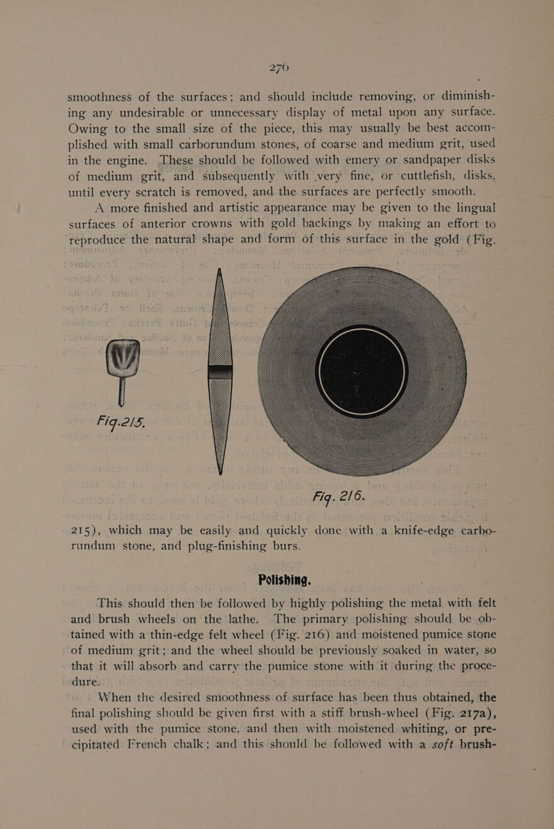2760 smoothness of the surfaces; and should include removing, or diminish- ing any undesirable or unnecessary display of metal upon any surface. Owing to the small size of the piece, this may usually be best accom- plished with small carborundum stones, of coarse and medium grit, used in the engine. These should be followed with emery or sandpaper disks of medium grit, and subsequently with very fine, or cuttlefish, disks, until every scratch is removed, and.the surfaces are perfectly smooth. A more finished and artistic appearance may be given to the lingual surfaces of anterior crowns with gold backings by making an effort to ‘reproduce the natural shape and form of this surface in the gold (Fig. _ 215), which may be easily and quickly done with a knife-edge carbo- rundum stone, and plug-finishing burs. rest Polishing. This should then be followed by highly polishing the metal with felt and brush wheels on the lathe. The primary polishing should be ob- tained with a thin-edge felt wheel (Fig. 216) and moistened pumice stone of medium grit; and the wheel should be previously soaked in water, so that it will absorb and carry the pumice stone with it’ during the proce- dure. . - When the desired smoothness of surface has been thus obtained, the final polishing should be given first with a stiff brush-wheel (Fig. 217a), used with the pumice stone, and then with moistened whiting, or pre- cipitated. French chalk; and this should be followed with a soft brush-