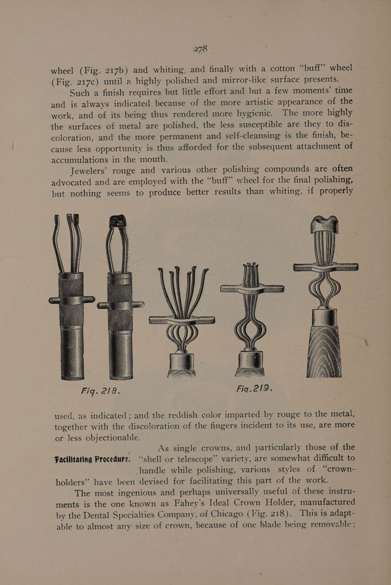 wheel (Fig. 217b) and whiting, and finally with a cotton “buff” wheel (Fig. 217c) until a highly polished and mirror-like surface presents. Such a finish requires but little effort and but a few moments’ time and is always indicated because of the more artistic appearance of the work, and of its being thus rendered more hygienic. The more highly the surfaces of metal are polished, the less susceptible are they to dis- coloration, and the more permanent and self-cleansing is the finish, be- cause less opportunity is thus afforded for the subsequent attachment of accumulations in the mouth. : Jewelers’ rouge and various other polishing compounds. are often advocated and are employed with the “buff” wheel for the final polishing, but nothing seems to produce better results than whiting, if properly used, as indicated; and the reddish color imparted by rouge to the metal, together with the discoloration of the fingers incident to its use, are more or less objectionable. As single crowns, and particularly those of the Facilitating Procedure. “shell or telescope” variety, are somewhat difficult to handle while polishing, various styles of “crown- holders” have been devised for facilitating this part of the work. The most ingenious and perhaps universally useful of these instru- ments is the one known as Fahey’s Ideal Crown Holder, manufactured by the Dental Specialties Company, of Chicago (Fig. 218). This is adapt- able to almost any size of crown, ‘because of one blade being removable ;