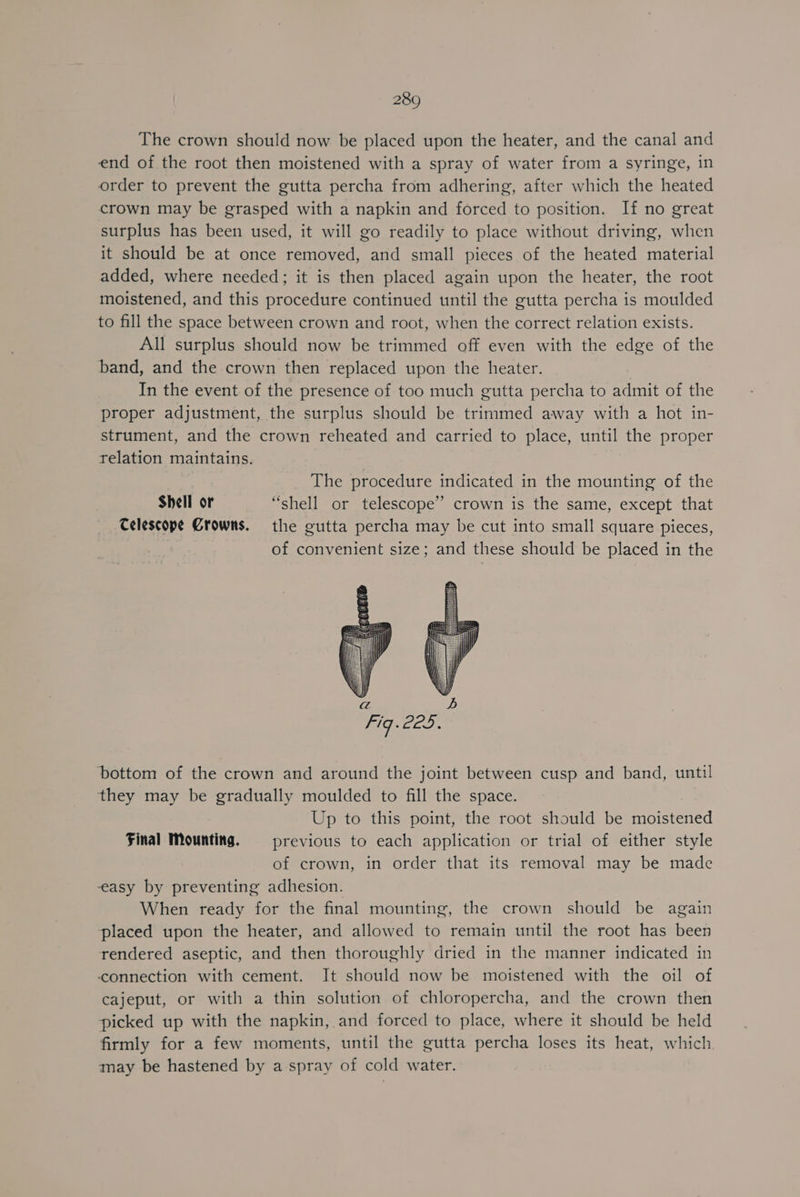 The crown should now be placed upon the heater, and the canal and end of the root then moistened with a spray of water from a syringe, in order to prevent the gutta percha from adhering, after which the heated crown may be grasped with a napkin and forced to position. If no great surplus has been used, it will go readily to place without driving, when it should be at once removed, and small pieces of the heated material added, where needed; it is then placed again upon the heater, the root moistened, and this procedure continued until the gutta percha is moulded to fill the space between crown and root, when the correct relation exists. All surplus should now be trimmed off even with the edge of the band, and the crown then replaced upon the heater. In the event of the presence of too much gutta percha to admit of the proper adjustment, the surplus should be trimmed away with a hot in- strument, and the crown reheated and carried to place, until the proper telation maintains. The procedure indicated in the mounting of the Shell or “shell or telescope” crown is the same, except that Celescope Crowns. the gutta percha may be cut into small square pieces, of convenient size; and these should be placed in the bottom of the crown and around the joint between cusp and band, until they may be gradually moulded to fill the space. Up to this point, the root should be moistened Final Mounting. = previous to each application or trial of either style of crown, in order that its removal may be made easy by preventing adhesion. When ready for the final mounting, the crown should be again placed upon the heater, and allowed to remain until the root has been rendered aseptic, and then thoroughly dried in the manner indicated in ‘connection with cement. It should now be moistened with the oil of cajeput, or with a thin solution of chloropercha, and the crown then picked up with the napkin, and forced to place, where it should be held firmly for a few moments, until the gutta percha loses its heat, which may be hastened by a spray of cold water.