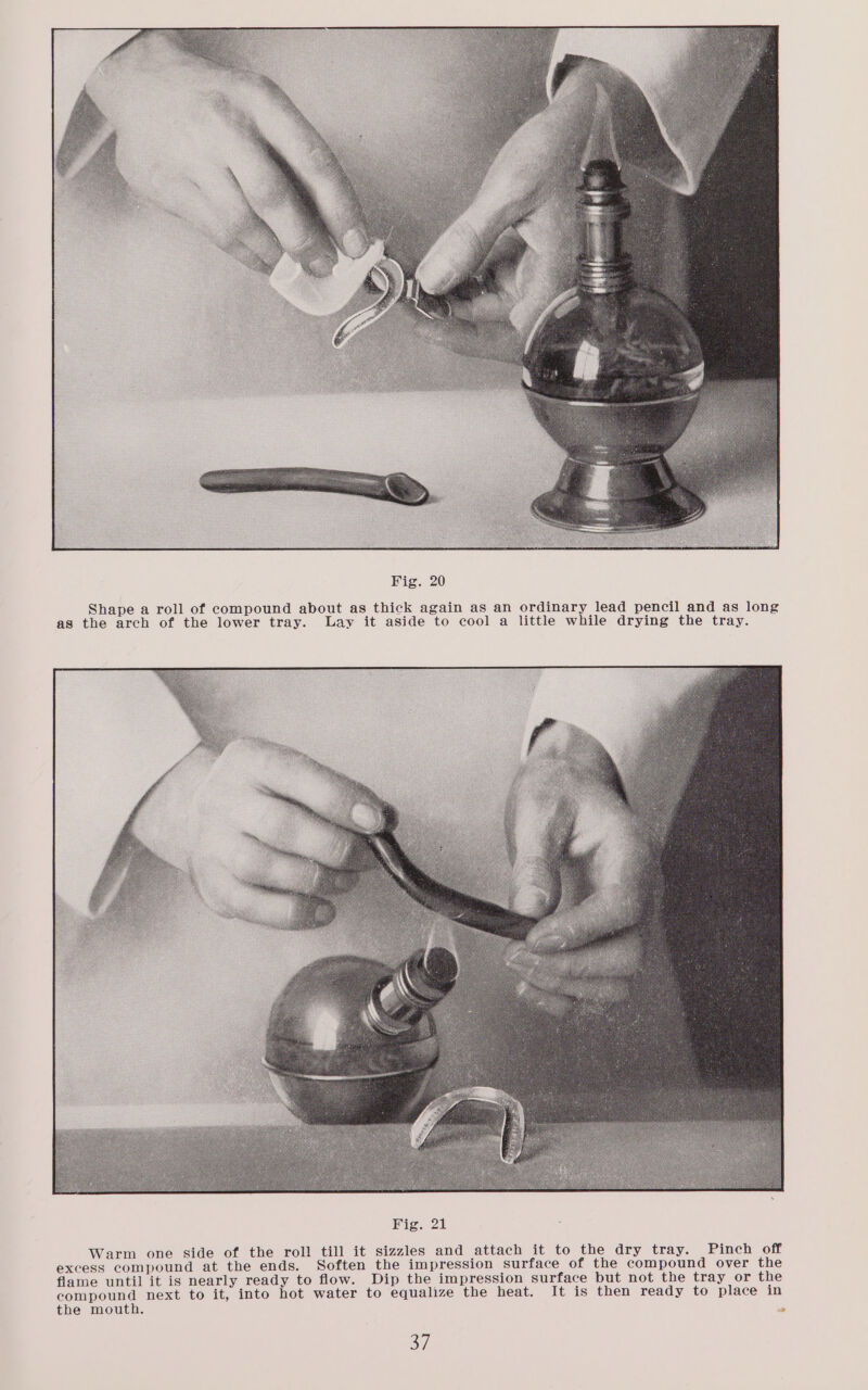 Shape a roll of compound about as thick again as an ordinary lead pencil and as long as the arch of the lower tray. Lay it aside to cool a little while drying the tray. Fig. 21 Warm one side of the roll till it sizzles and attach it to the dry tray. Pinch off excess compound at the ends. Soften the impression surface of the compound over the flame until it is nearly ready to flow. Dip the impression surface but not the tray or the compound next to it, into hot water to equalize the heat. It is then ready to place in the mouth. a 37]