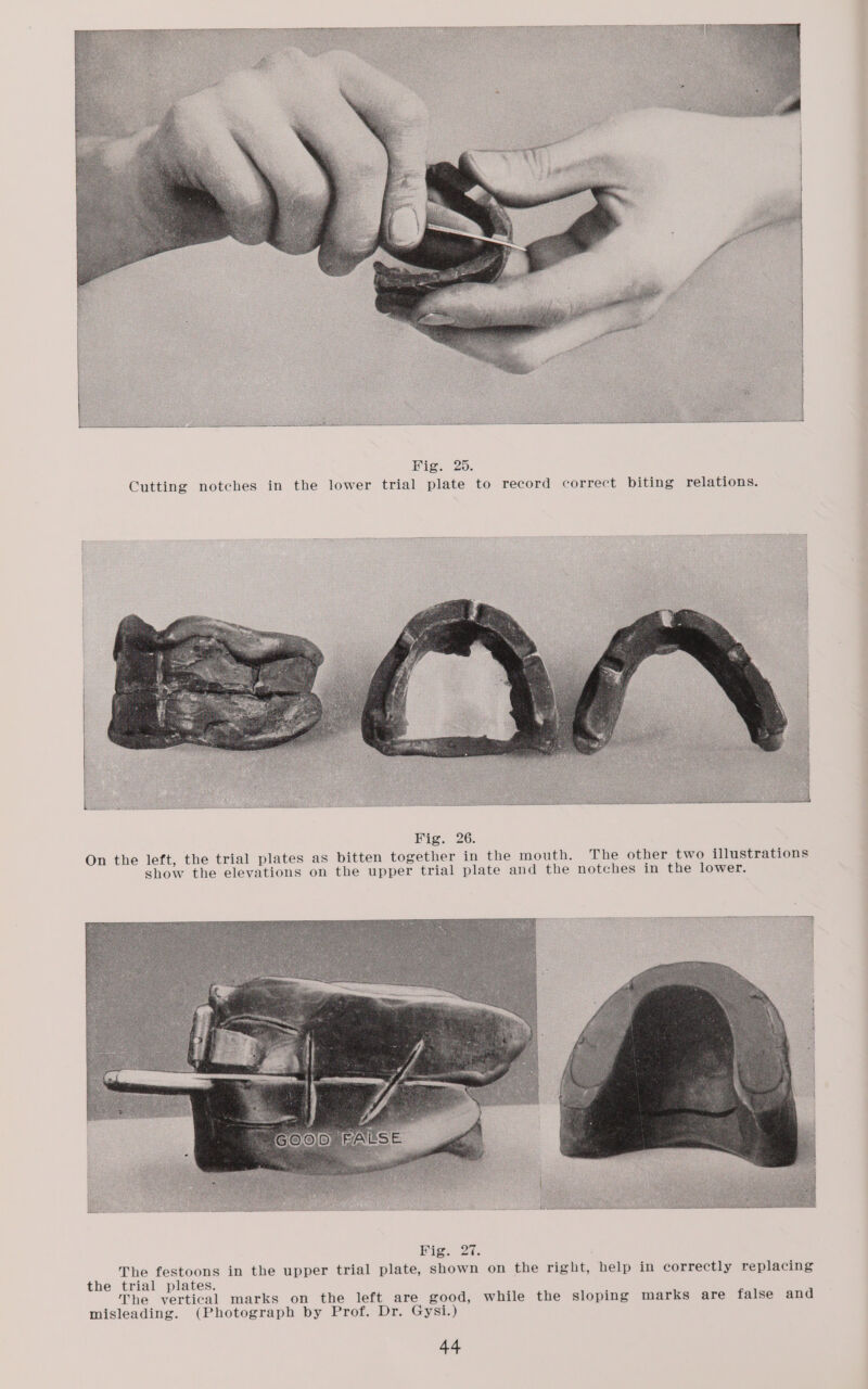 Hig. 20: Cutting notches in the lower trial plate to record correct biting relations. Fig. 26. On the left, the trial plates as bitten together in the mouth. The other two illustrations show the elevations on the upper trial plate and the notches in the lower.