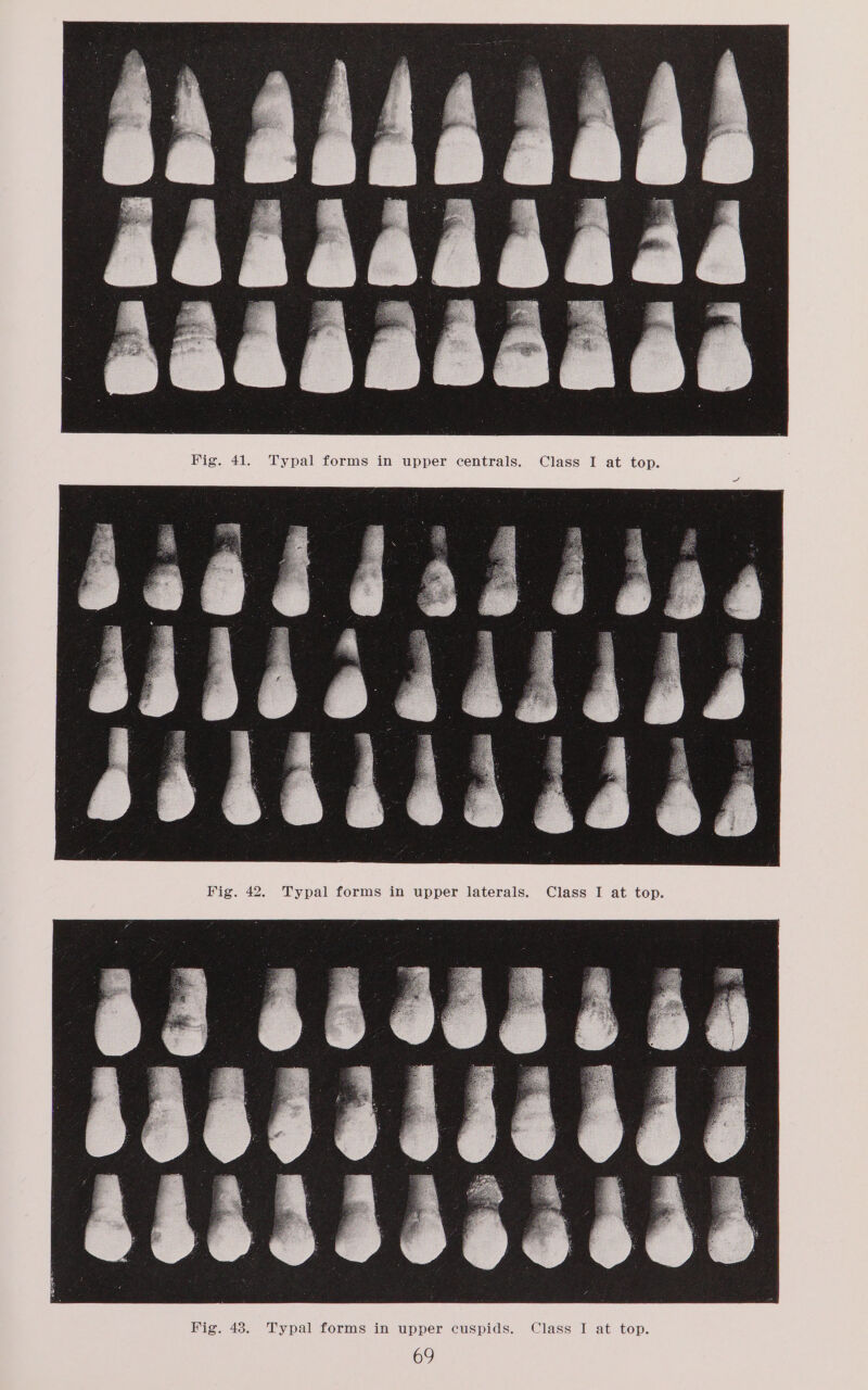 Typal forms in upper centrals. Class Fig. 42. Typal forms in upper laterals. Class See