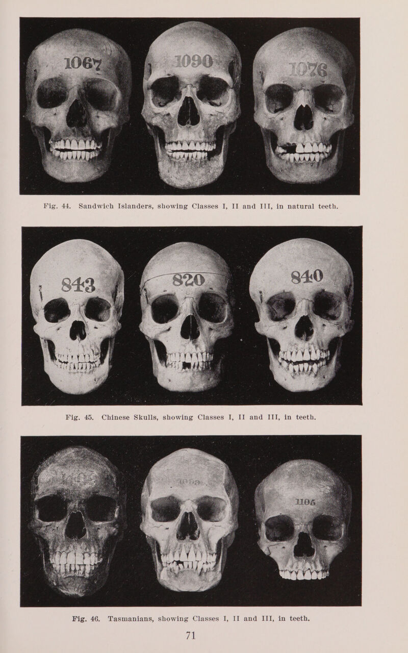 Sandwich Islanders, showing Classes I, II and III, in natural teeth Chinese Skulls, showing Classes I, II and III, in teeth. Fig. 45. teeth in II and III, i ses I, as fa (01 in Ss, Show sSmanian Ta