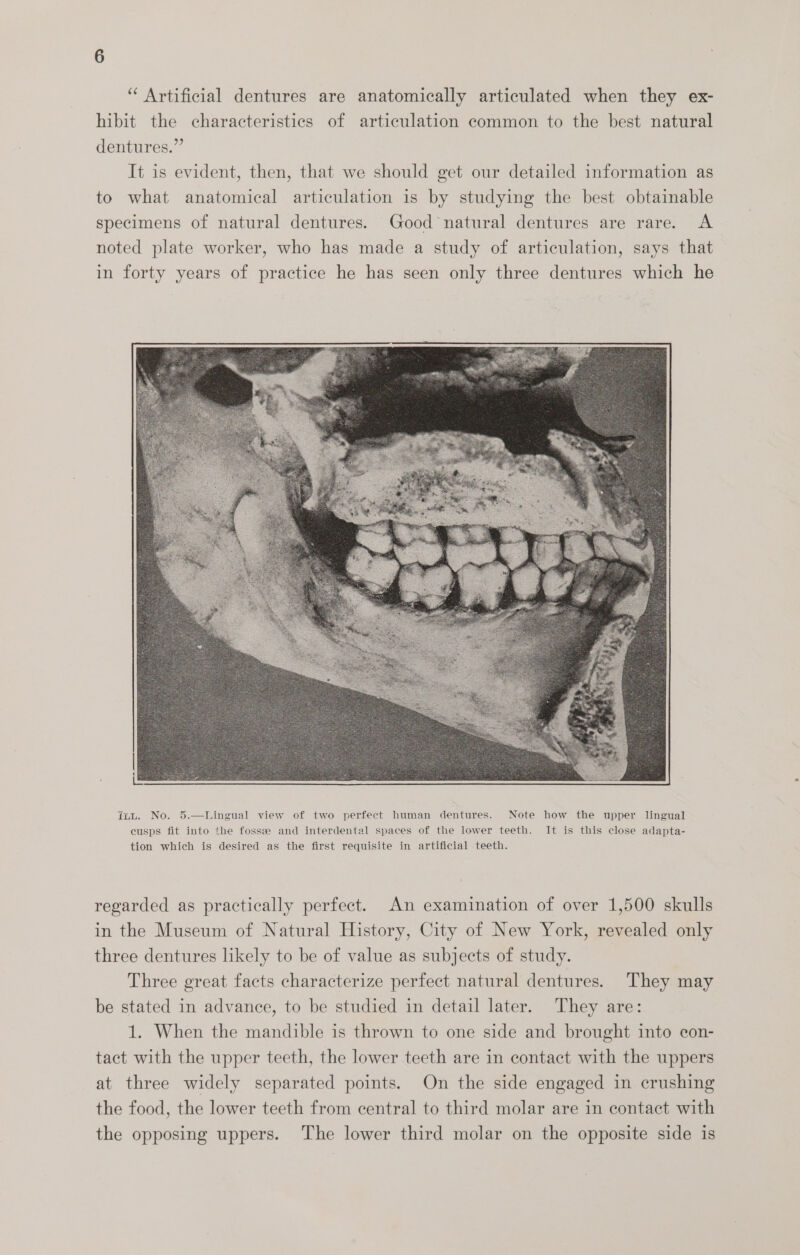 “ Artificial dentures are anatomically articulated when they ex- hibit the characteristics of articulation common to the best natural dentures.” It is evident, then, that we should get our detailed information as to what anatomical articulation is by studying the best obtainable specimens of natural dentures. Good natural dentures are rare. A noted plate worker, who has made a study of articulation, says that in forty years of practice he has seen only three dentures which he iwt. No. 5.—Lingual view of two perfect human dentures. Note how the upper lingual cusps fit into the fossee and interdental spaces of the lower teeth. It is this close adapta- tion which is desired as the first requisite in artificial teeth. regarded as practically perfect. An examination of over 1,500 skulls in the Museum of Natural History, City of New York, revealed only three dentures likely to be of value as subjects of study. Three great facts characterize perfect natural dentures. They may be stated in advance, to be studied in detail later. They are: 1. When the mandible is thrown to one side and brought into con- tact with the upper teeth, the lower teeth are in contact with the uppers at three widely separated points. On the side engaged in crushing the food, the lower teeth from central to third molar are in contact with the opposing uppers. The lower third molar on the opposite side is