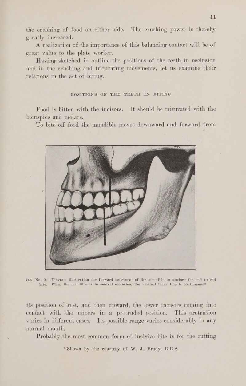 the crushing of food on either side. The crushing power is thereby greatly increased. A realization of the importance of this balancing contact will be of great value to the plate worker. Having sketched in outline the positions of the teeth in occlusion and in the crushing and triturating movements, let us examine their relations in the act of biting. POSITIONS OF THE THETH IN BIrrinG Food is bitten with the incisors. It should be triturated with the bicuspids and molars. To bite oft food the mandible moves downward and forward from itu. No. 9.—Diagram illustrating the forward movement of the mandible to produce the end to end bite. When the mandible is in central occlusion, the vertical black line is continuous.* its position of rest, and then upward, the lower incisors coming into contact with the uppers in a protruded position. This protrusion varies in different cases. Its possible range varies considerably in any normal mouth. Probably the most common form of incisive bite is for the cutting