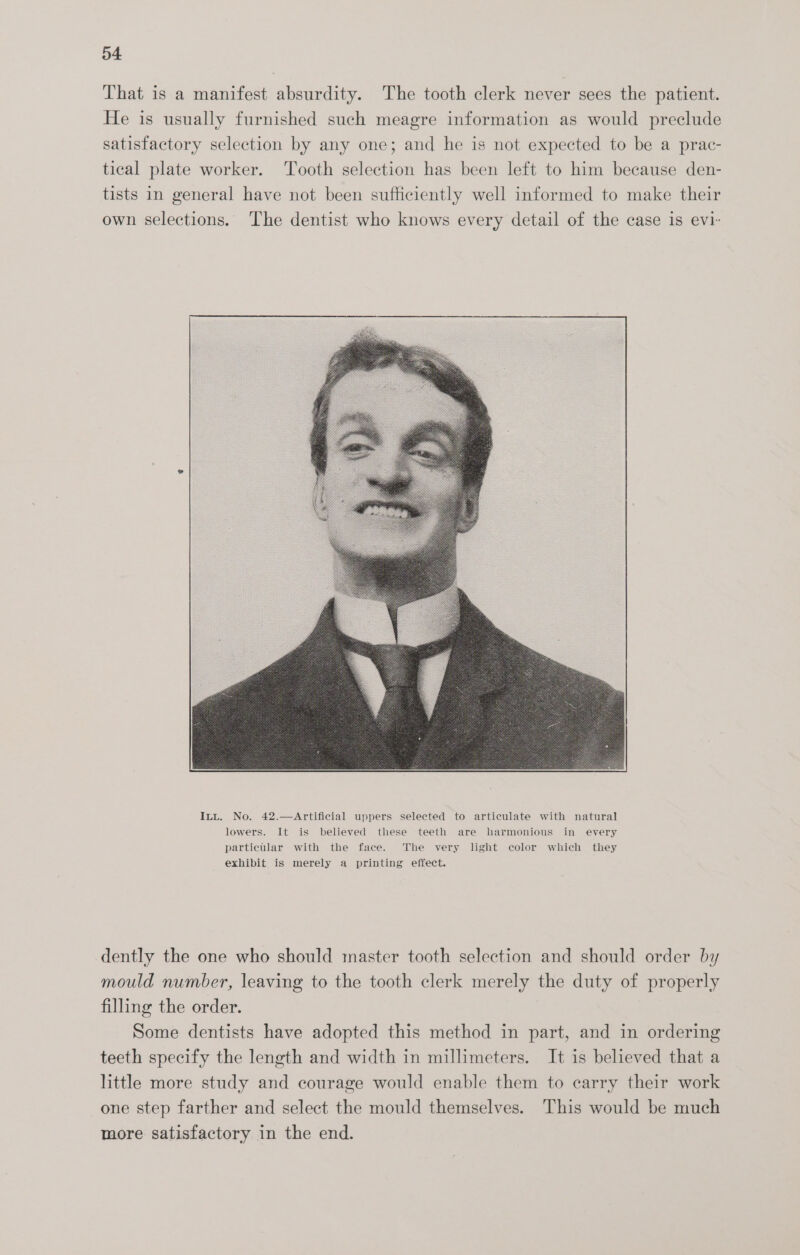 That is a manifest absurdity. The tooth clerk never sees the patient. He is usually furnished such meagre information as would preclude satisfactory selection by any one; and he is not expected to be a prac- tical plate worker. ‘Tooth selection has been left to him because den- tists in general have not been sufticiently well informed to make their own selections. The dentist who knows every detail of the case is evi- dently the one who should master tooth selection and should order by mould number, leaving to the tooth clerk merely the duty of properly filling the order. Some dentists have adopted this method in part, and in ordering teeth specify the length and width in millimeters. It is believed that a little more study and courage would enable them to carry their work one step farther and select the mould themselves. This would be much more satisfactory in the end.