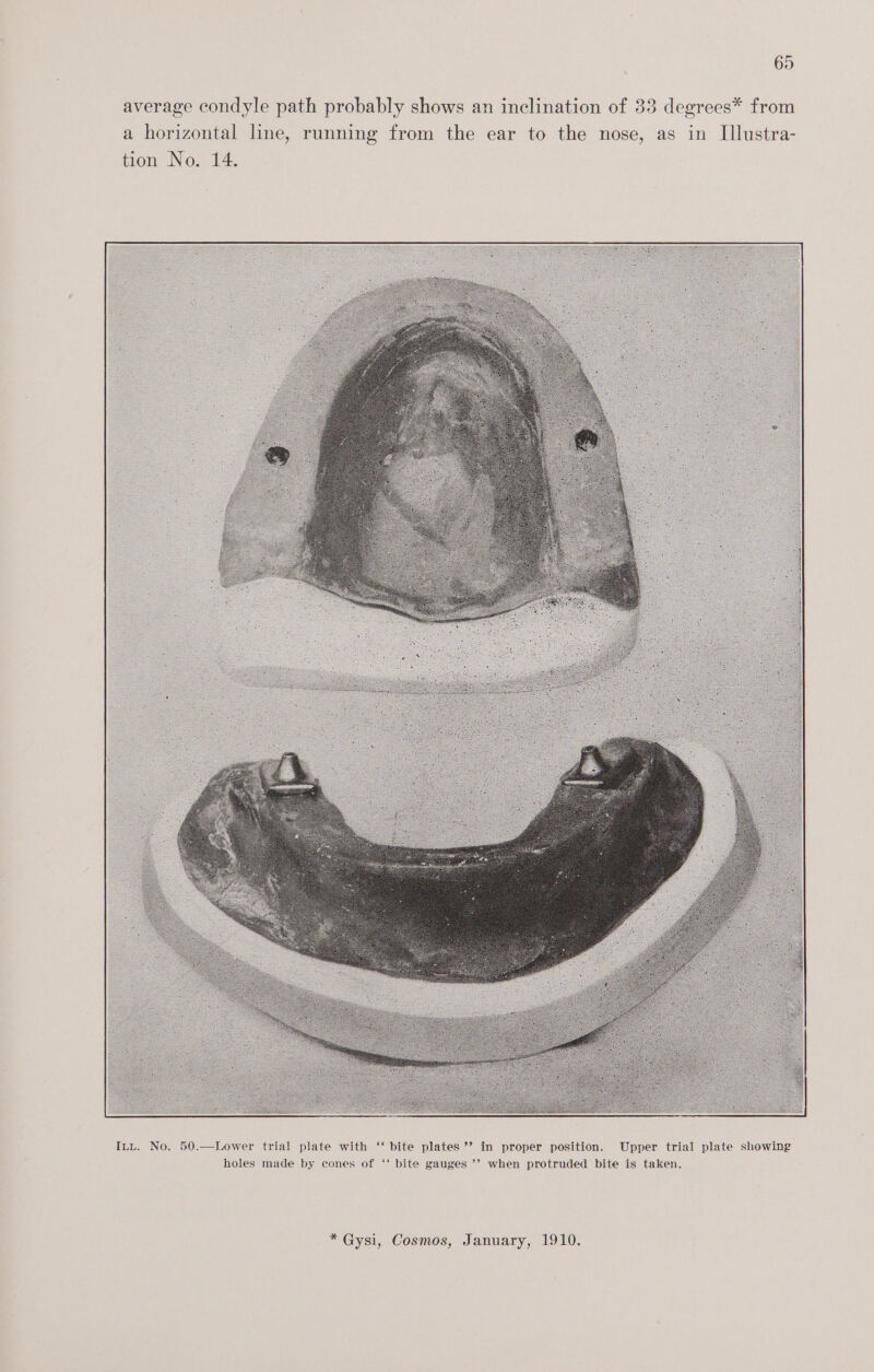 average condyle path probably shows an inclination of 33 degrees* from a horizontal line, running from the ear to the nose, as in Illustra- tion No. 14.