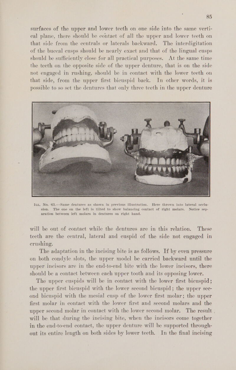 surfaces of the upper and lower teeth on one side into the same verti- eal plane, there should be contact of all the upper and lower teeth on that side from the centrals or laterals backward. The interdigitation of the buceal cusps should be nearly exact and that of the lingual cusps should be sufficiently close for all practical purposes. At the same time the teeth on the opposite side of the upper denture, that 1s on the side not engaged in rushing, should be in contact with the lower teeth on that side, from the upper first bicuspid back. In other words, it is possible to so set the dentures that only three teeth in the upper denture will be out of contact while the dentures are in this relation. These teeth are the central, lateral and cuspid of the side not engaged in crushing. The adaptation in the incising bite is as follows. If by even pressure on both condyle slots, the upper model be carried backward until the upper incisors are in the end-to-end bite with the lower incisors, there should be a contact between each upper tooth and its opposing lower. The upper cuspids will be in contact with the lower first bicuspid; the upper first bicuspid with the lower second bicuspid; the upper sec- ond bicuspid with the mesial cusp of the lower first molar; the upper first molar in contact with the lower first and second molars and the upper second molar in contact with the lower second molar. The result , will be that during the incising bite, when the incisors come together in the end-to-end contact, the upper denture will be supported through- out its entire length on both sides by lower teeth. In the final incising