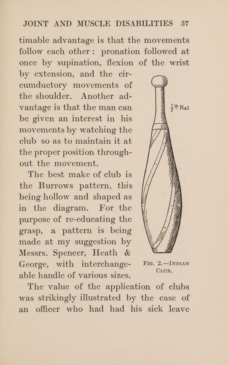 by extension, and the cir- cumductory movements of the shoulder. Another ad- vantage is that the man can be given an interest in his movements by watching the club so as to maintain it at the proper position through- out the movement. The best make of club is the Burrows pattern, this being hollow and shaped as in the diagram. For the purpose of re-educating the grasp, a pattern is being made at my suggestion by Messrs. Spencer, Heath &amp; George, with interchange- able handle of various sizes. Fia. 2.—INDIAN CLUB.