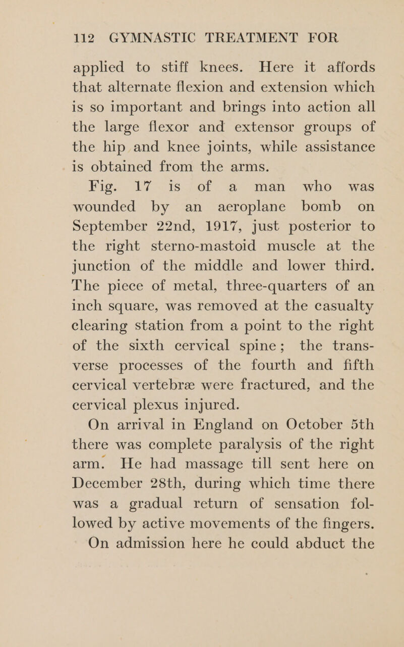 applied to stiff knees. Here it affords that alternate flexion and extension which is so important and brings into action all the large flexor and extensor groups of the hip and knee joints, while assistance is obtained from the arms. Fig... 27°18. Or “a “man whe. was wounded by an aeroplane bomb on September 22nd, 1917, just posterior to the right sterno-mastoid muscle at the junction of the middle and lower third. The piece of metal, three-quarters of an inch square, was removed at the casualty clearing station from a point to the right of the sixth cervical spine; the trans- verse processes of the fourth and fifth cervical vertebre were fractured, and the cervical plexus injured. On arrival in England on October 5th there was complete paralysis of the right arm. He had massage till sent here on December 28th, during which time there was a gradual return of sensation fol- lowed by active movements of the fingers. On admission here he could abduct the