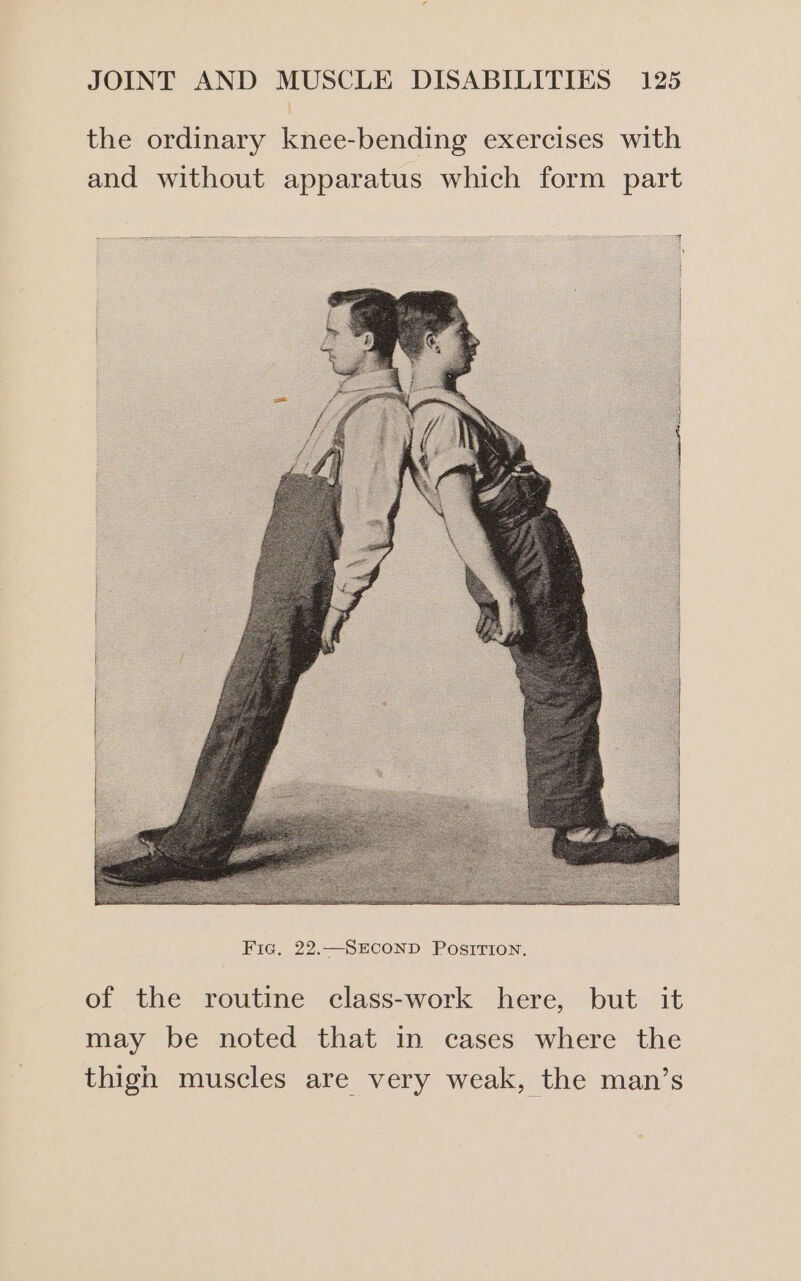 the ordinary knee-bending exercises with and without apparatus which form part of the routine class-work here, but it may be noted that in cases where the thigh muscles are very weak, the man’s