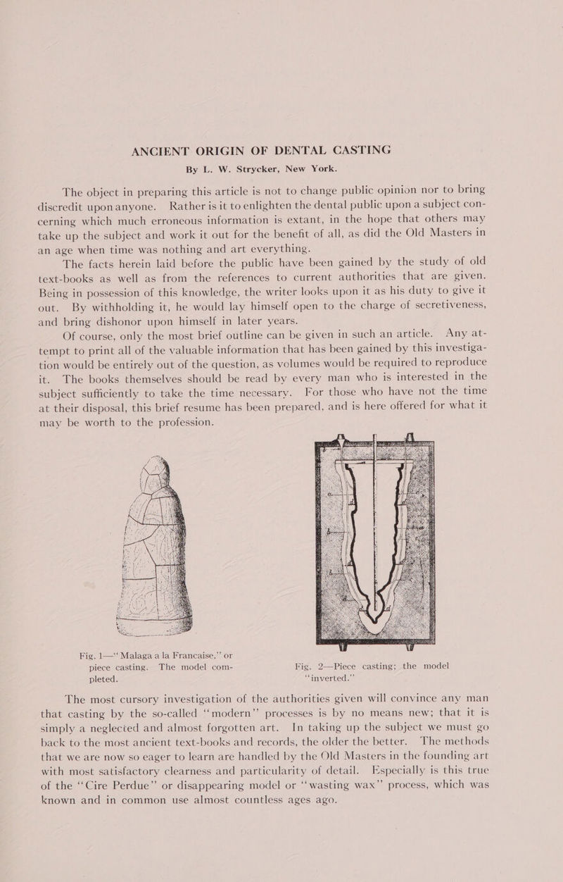 By L. W. Strycker, New York. The object in preparing this article is not to change public opinion nor to bring discredit uponanyone. Rather is it to enlighten the dental public upon a subject con- cerning which much erroneous information is extant, in the hope that others may take up the subject and work it out for the benefit of all, as did the Old Masters in an age when time was nothing and art everything. The facts herein laid before the public have been gained by the study of old text-books as well as from the references to current authorities that are given. Being in possession of this knowledge, the writer looks upon it as his duty to give it out. By withholding it, he would lay himself open to the charge of secretiveness, and bring dishonor upon himself in later years. Of course, only the most brief outline can be given in such an article. Any at- tempt to print all of the valuable information that has been gained by this investiga- tion would be entirely out of the question, as volumes would be required to reproduce it. The books themselves should be read by every man who is interested in the subject sufficiently to take the time necessary. For those who have not the time at their disposal, this brief resume has been prepared, and is here offered for what it may be worth to the profession. Fig. 1—‘‘ Malaga a la Francaise,’ or piece casting. The model com- Fig. 2—Piece casting; the model pleted. “inverted.” The most cursory investigation of the authorities given will convince any man that casting by the so-called ‘‘modern”’ processes is by no means new; that it is simply a neglected and almost forgotten art. In taking up the subject we must go back to the most ancient text-books and records, the older the better. The methods that we are now so eager to learn are handled by the Old Masters in the founding art with most satisfactory clearness and particularity of detail. Especially is this true of the ‘‘Cire Perdue” or disappearing model or ‘‘ wasting wax’”’ process, which was known and in common use almost countless ages ago.