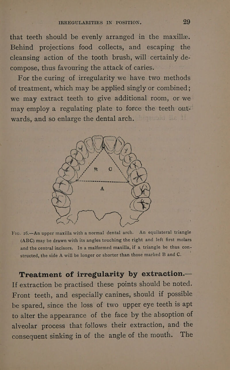 that teeth should be evenly arranged in the maxille. Behind projections food collects, and escaping the cleansing action of the tooth brush, will certainly de- compose, thus favouring the attack of caries. For the curing of irregularity we have two methods of treatment, which may be applied singly or combined; we may extract teeth to give additional room, or we may employ a regulating plate to force the teeth out- wards, and so enlarge the dental arch. | Fic. 16.—An upper maxilla with a normal dental arch. An equilateral triangle (ABC) may be drawn with its angles touching the right and left first molars and the central incisors. In a malformed maxilla, if a triangle be thus con- structed, the side A will be longer or shorter than those marked B and C. Treatment of irregularity by extraction.— If extraction be practised these points should be noted. Front teeth, and especially canines, should if possible be spared, since the loss of two upper eye teeth is apt to alter the appearance of the face by the absoption of alveolar process that follows their extraction, and the consequent sinking in of the angle of the mouth. The