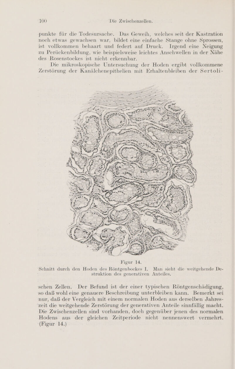 punkte für die Todesursache. Das Geweih, welches seit der Kastration noch etwas gewachsen war, bildet eine einfache Stange ohne Sprossen, ist vollkommen behaart und federt auf Druck. Irgend eine Neigung zu Perückenbildung, wie beispielsweise leichtes Anschwellen in der Nähe des Rosenstockes ist nicht erkennbar. Die mikroskopische Untersuchung der Hoden ergibt vollkommene Zerstörung der Kanälchenepithelien mit Erhaltenbleiben der Sertoli- ya. CH RT Bonn “ i Figur 14. Schnitt durch den Hoden des Röntgenbockes I. Man sieht die weitgehende De- struktion des generativen Anteiles. schen Zellen. Der Befund ist der einer typischen Röntgenschädigung, so daß wohl eine genauere Beschreibung unterbleiben kann. Bemerkt sei nur, daß der Vergleich mit einem normalen Hoden aus derselben Jahres- zeit die weitgehende Zerstörung der generativen Anteile sinnfällig macht. Die Zwischenzellen sind vorhanden, doch gegenüber jenen des normalen Hodens aus der gleichen Zeitperiode nicht nennenswert vermehrt. (Figur 14.)