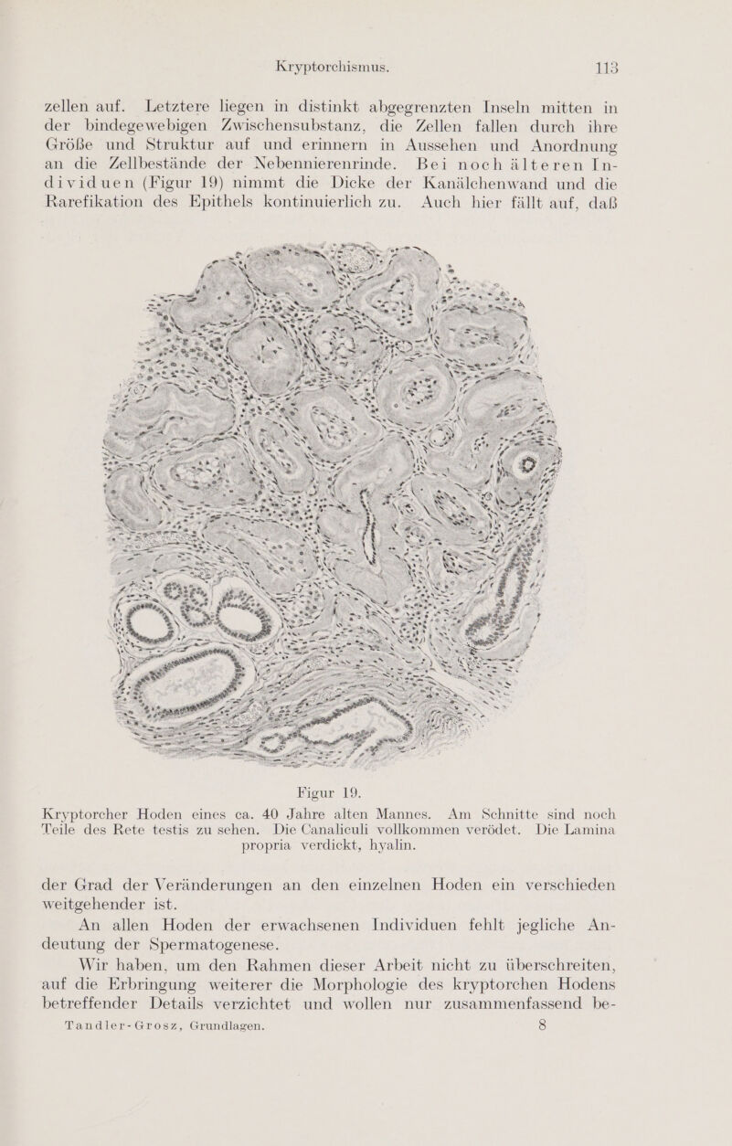 zellen auf. Letztere liegen in distinkt abgegrenzten Inseln mitten in der bindegewebigen Zwischensubstanz, die Zellen fallen durch ihre Größe und Struktur auf und erinnern in Aussehen und Anordnung an die Zellbestände der Nebennierenrinde. Bei nochälteren In- dividuen (Figur 19) nimmt die Dicke der Kanälchenwand und die Rarefikation des Epithels kontinuierlich zu. Auch hier fällt auf, daß der Grad der Veränderungen an den einzelnen Hoden ein verschieden weitgehender ist. An allen Hoden der erwachsenen Individuen fehlt jegliche An- deutung der Spermatogenese. Wir haben, um den Rahmen dieser Arbeit nicht zu überschreiten, auf die Erbringung weiterer die Morphologie des kryptorchen Hodens betreffender Details verzichtet und wollen nur zusammenfassend be- Tandler-Grosz, Grundlagen. 8