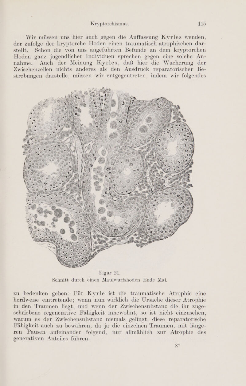 Wir müssen uns hier auch gegen die Auffassung Kyrles wenden, der zufolge der kryptorche Hoden einen traumatisch-atrophischen dar- stellt. Schon die von uns angeführten Befunde an dem kryptorchen Hoden ganz jugendlicher Individuen sprechen gegen eine solche An- nahme. Auch der Meinung Kyrles, daß hier die Wucherung der Zwischenzellen nichts anderes als den Ausdruck reparatorischer Be- strebungen darstelle, müssen wir entgegentreten, indem wir folgendes zu bedenken geben: Für Kyrle ist die traumatische Atrophie eine herdweise eintretende; wenn nun wirklich die Ursache dieser Atrophie in den Traumen liegt, und wenn der Zwischensubstanz die ihr zuge- schriebene regenerative Fähigkeit innewohnt, so ist nicht einzusehen, warum es der Zwischensubstanz niemals gelingt, diese reparatorische Fähigkeit auch zu bewähren, da ja die einzelnen Traumen, mit länge- ren Pausen aufeinander folgend, nur allmählich zur Atrophie des generativen Anteiles führen. | Q*