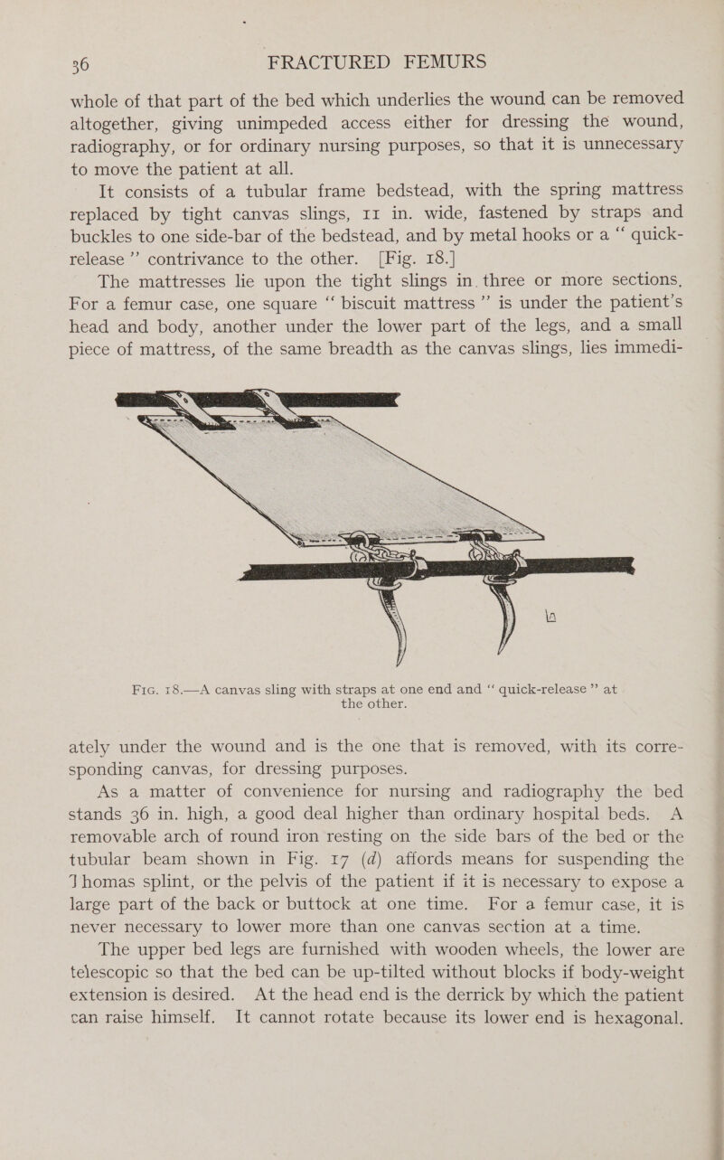 whole of that part of the bed which underlies the wound can be removed altogether, giving unimpeded access either for dressing the wound, radiography, or for ordinary nursing purposes, so that it is unnecessary to move the patient at all. It consists of a tubular frame bedstead, with the spring mattress replaced by tight canvas slings, 11 in. wide, fastened by straps and buckles to one side-bar of the bedstead, and by metal hooks or a “ quick- release ’’ contrivance to the other. [Fig. 18.] The mattresses lie upon the tight slings in. three or more sections, For a femur case, one square ‘‘ biscuit mattress ’’ is under the patient’s head and body, another under the lower part of the legs, and a small piece of mattress, of the same breadth as the canvas slings, lies immedi- Fic. 18.—A canvas sling with straps at one end and “‘ quick-release ”’ at the other. ately under the wound and is the one that is removed, with its corre- sponding canvas, for dressing purposes. As a matter of convenience for nursing and radiography the bed stands 36 in. high, a good deal higher than ordinary hospital beds. A removable arch of round iron resting on the side bars of the bed or the tubular beam shown in Fig. 17 (d) affords means for suspending the Thomas splint, or the pelvis of the patient if it is necessary to expose a large part of the back or buttock at one time. For a femur case, it is never necessary to lower more than one canvas section at a time. The upper bed legs are furnished with wooden wheels, the lower are telescopic so that the bed can be up-tilted without blocks if body-weight extension is desired. At the head end is the derrick by which the patient can raise himself. It cannot rotate because its lower end is hexagonal.