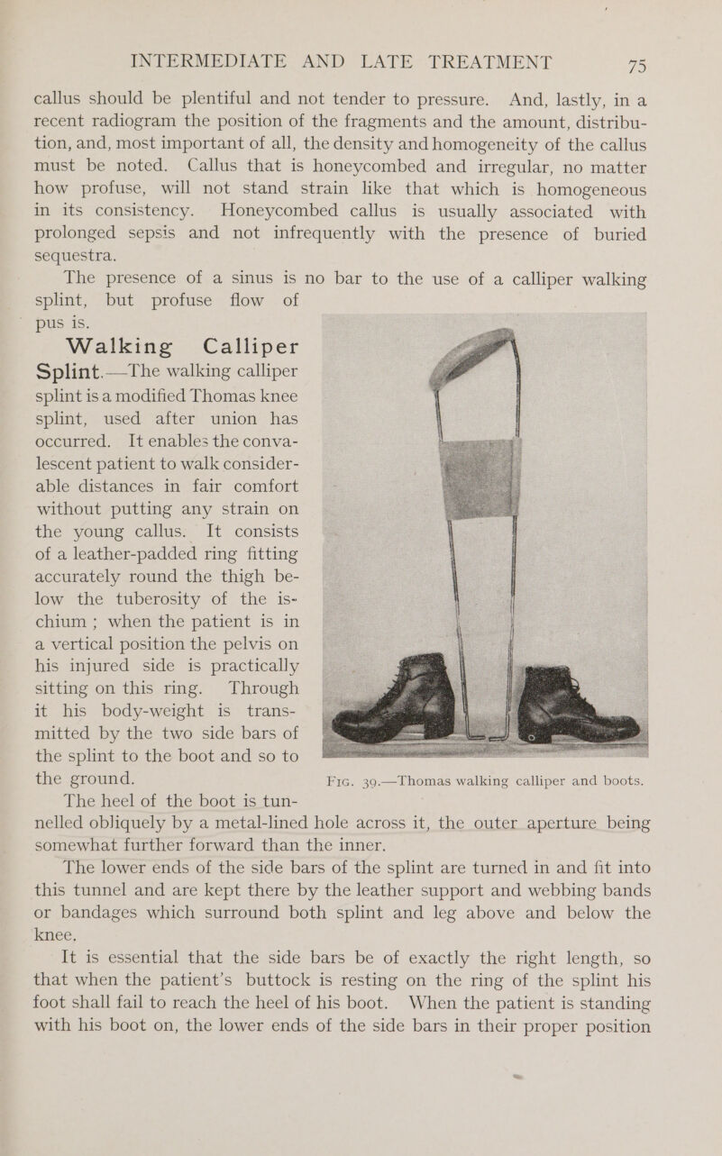 callus should be plentiful and not tender to pressure. And, lastly, in a recent radiogram the position of the fragments and the amount, distribu- tion, and, most important of all, the density and homogeneity of the callus must be noted. Callus that is honeycombed and irregular, no matter how profuse, will not stand strain like that which is homogeneous in its consistency. _Honeycombed callus is usually associated with prolonged sepsis and not infrequently with the presence of buried sequestra. The presence of a sinus is no bar to the use of a calliper walking splint, but profuse flow of pus is. Walking Calliper Splint.—The walking calliper splint isa modified Thomas knee splint, used after union has occurred. It enables the conva- lescent patient to walk consider- able distances in fair comfort without putting any strain on the young callus. It consists of a leather-padded ring fitting accurately round the thigh be- low “the -twberasity. ‘of the 1s- chium ; when the patient is in a vertical position the pelvis on his injured side is practically sitting on this ring. Through it his body-weight is trans- mitted by the two side bars of the splint to the boot and so to the ground. Fic. 39.—Thomas walking calliper and boots. The heel of the boot is tun- nelled obliquely by a metal-lined hole across it, the outer aperture being somewhat further forward than the inner. The lower ends of the side bars of the splint are turned in and fit into this tunnel and are kept there by the leather support and webbing bands or bandages which surround both splint and leg above and below the knee, It is essential that the side bars be of exactly the right length, so that when the patient’s buttock is resting on the ring of the splint his foot shall fail to reach the heel of his boot. When the patient is standing with his boot on, the lower ends of the side bars in their proper position