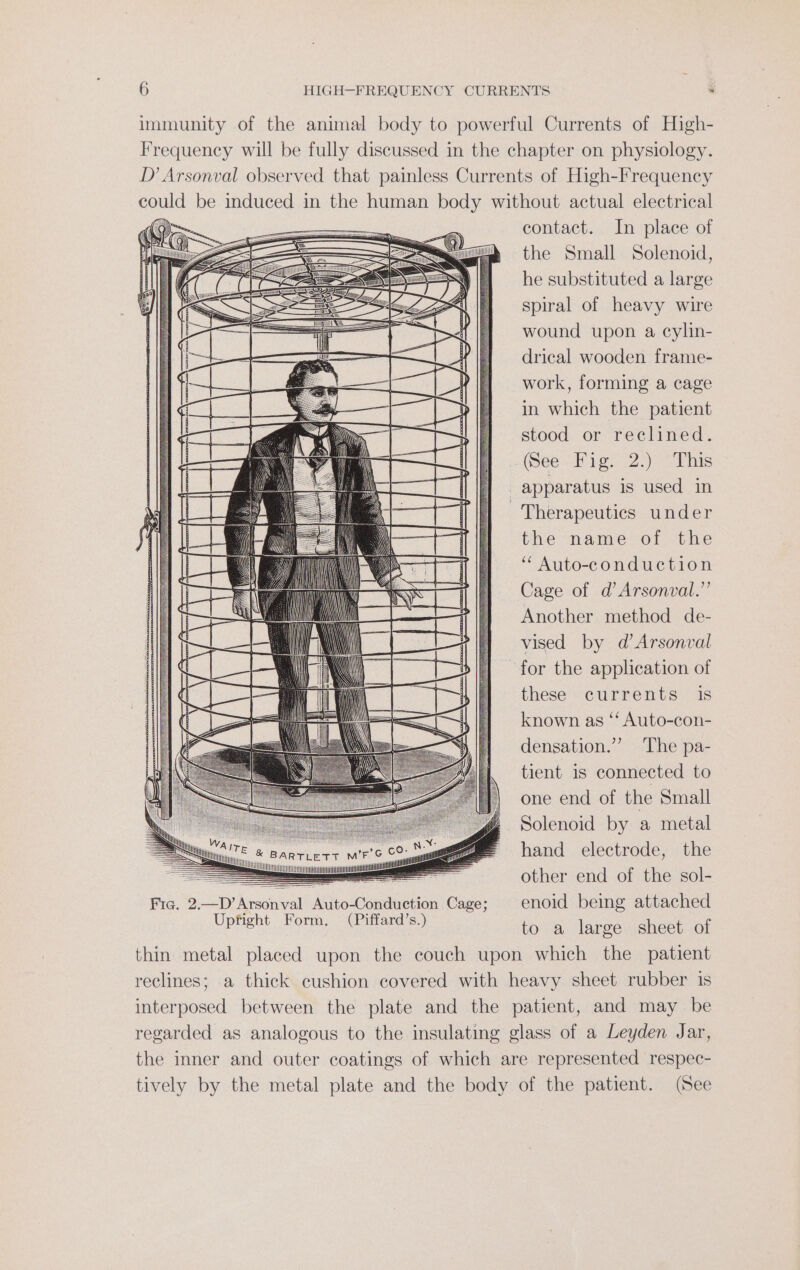 immunity of the animal body to powerful Currents of High- Frequency will be fully discussed in the chapter on physiology. D Arsonval observed that painless Currents of High-Frequency hout actual electrical contact. In place of the Small Solenoid, he substituted a large spiral of heavy wire wound upon a cylin- drical wooden frame- work, forming a cage in which the patient stood or reclined. eoee bilge 2.) tbs apparatus is used in Therapeutics under the name of the ‘“ Auto-conduction Cage of d’Arsonval.”’ Another method de- vised by d’ Arsonval for the application of these currents is known as ‘‘ Auto-con- densation.’’ The pa- tient is connected to one end of the Small Solenoid by a metal hand electrode, the other end of the sol- enoid being attached to a large sheet of thin metal placed upon the couch upon which the patient reclines; a thick cushion covered with heavy sheet rubber is interposed between the plate and the patient, and may be regarded as analogous to the insulating glass of a Leyden Jar, the inner and outer coatings of which are represented respec- tively by the metal plate and the body of the patient. (See
