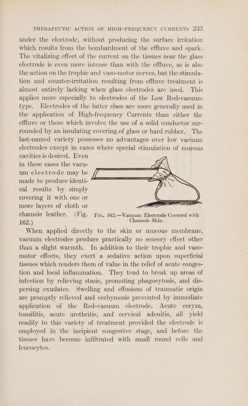 under the electrode, without producing the surface irritation which results from the bombardment of the effluve and spark. The vitalizing effect of the current on the tissues near the glass electrode is even more intense than with the effluve, as is also the action on the trophic and vaso-motor nerves, but the stimula- tion and counter-irritation resulting from effluve treatment is almost entirely lacking when glass electrodes are used. This applies more especially to electrodes of the Low Red-vacuum type. Electrodes of the latter class are more generally used in the application of High-frequency Currents than either the effluve or those which involve the use of a solid conductor sur- rounded by an insulating covering.of glass or hard rubber. The last-named variety possesses no advantages over low vacuum electrodes except in cases where special stimulation . mucous cavities is desired. Even in these cases the vacu- um electrode may be made to produce identi- cal results by simply covering it with one or more layers of cloth or chamois leather. (Fig. Fic. 162.—Vacuum Electrode Covered wih 162. ) Chamois Skin. When applied directly to the skin or mucous membrane, vacuum electrodes produce practically no sensory effect other than a slight warmth. In addition to their trophic and vaso- motor effects, they exert a sedative action upon superficial tissues which renders them of value in the relief of acute conges- tion and local inflammation. They tend to break up areas of infection by relieving stasis, promoting phagocytosis, and dis- persing exudates. Swelling and effusions of traumatic origin are promptly relieved and ecchymosis prevented by immediate application of the Red-vacuum electrode. Acute coryza, tonsilitis, acute urethritis, and cervical adenitis, all yield readily to this variety of treatment provided the electrode is employed in the incipient congestive stage, and before the tissues have become infiltrated with small round cells and leucocytes.