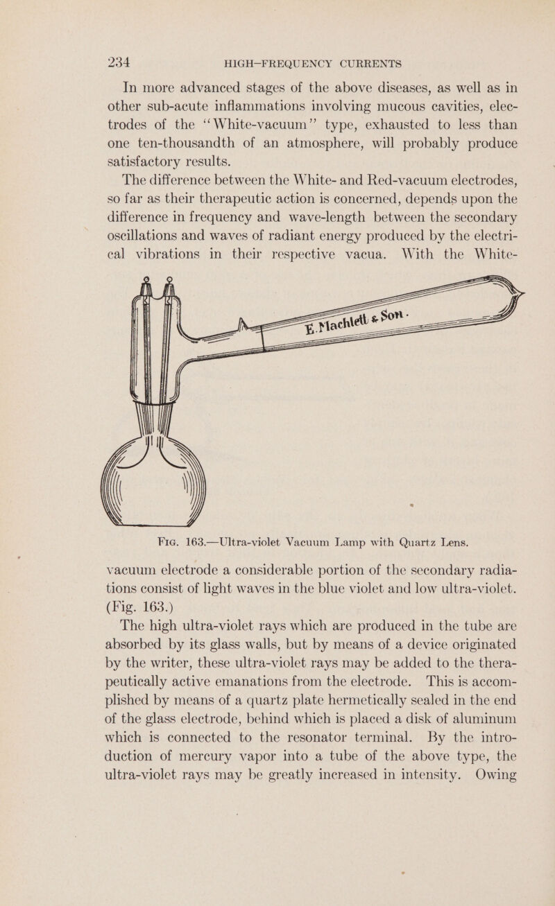 In more advanced stages of the above diseases, as well as in other sub-acute inflammations involving mucous cavities, elec- trodes of the ‘‘White-vacuum”’ type, exhausted to less than one ten-thousandth of an atmosphere, will probably produce satisfactory results. The difference between the White- and Red-vacuum electrodes, so far as their therapeutic action is concerned, depends upon the difference in frequency and wave-length between the secondary oscillations and waves of radiant energy produced by the electri- cal vibrations in their respective vacua. With the White- AN Cie ly ( | \ . y S Fie. 163.—Ultra-violet Vacuum Lamp with Quartz Lens. vacuum electrode a considerable portion of the secondary radia- tions consist of light waves in the blue violet and low ultra-violet. (Fig. 163.) The high ultra-violet rays which are produced in the tube are absorbed by its glass walls, but by means of a device originated by the writer, these ultra-violet rays may be added to the thera- peutically active emanations from the electrode. This is accom- plished by means of a quartz plate hermetically sealed in the end of the glass electrode, behind which is placed a disk of aluminum which is connected to the resonator terminal. By the intro- duction of mercury vapor into a tube of the above type, the ultra-violet rays may be greatly increased in intensity. Owing
