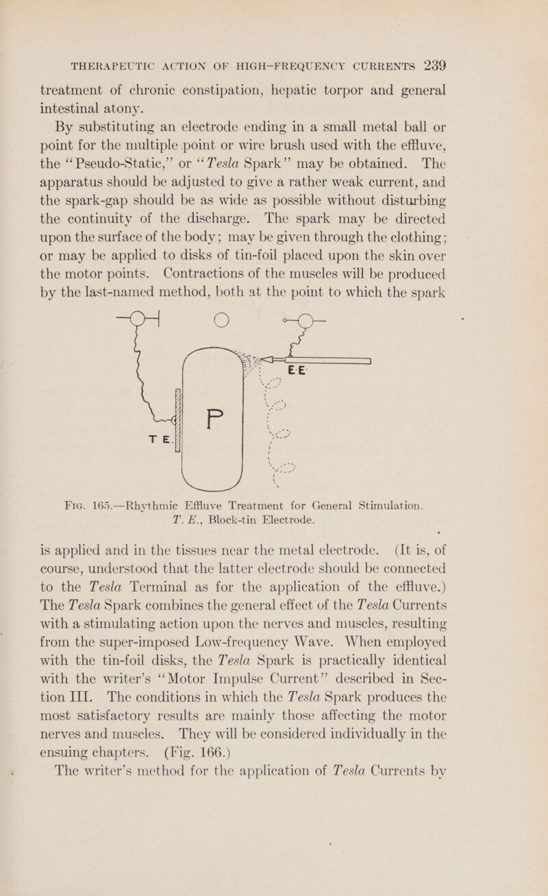 treatment of chronic constipation, hepatic torpor and general intestinal atony. By substituting an electrode ending in a small metal ball or point for the multiple point or wire brush used with the effluve, the ‘‘ Pseudo-Static,”’ or ‘Tesla Spark”? may be obtained. The apparatus should be adjusted to give a rather weak current, and the spark-gap should be as wide as possible without disturbing the continuity of the discharge. The spark may be directed upon the surface of the body; may be given through the clothing; or may be applied to disks of tin-foil placed upon the skin over the motor points. Contractions of the muscles will be produced by the last-named method, both at the point to which the spark =&gt; 774 27.7, 7 a Roa. At Of ’ aS ‘ ' iy , anys Fie. 165.—Rhythmic Effluve Treatment for General Stimulation. T.E., Block-tin Electrode. is applied and in the tissues near the metal electrode. (It 1s, of course, understood that the latter electrode should be connected to the Tesla Terminal as for the application of the effluve.) The Tesla Spark combines the general effect of the Tesla Currents with a stimulating action upon the nerves and muscles, resulting from the super-imposed Low-frequency Wave. When employed with the tin-foil disks, the Tesla Spark is practically identical with the writer’s ‘“‘Motor Impulse Current”? described in Sec- tion III. The conditions in which the Tesla Spark produces the most satisfactory results are mainly those affecting the motor nerves and muscles. They will be considered individually in the ensuing chapters. (Fig. 166.) The writer’s method for the application of Tesla Currents by
