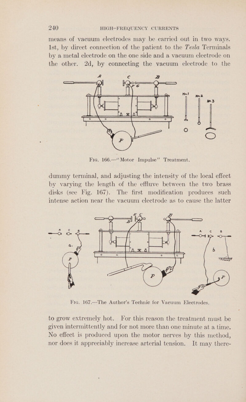 means of vacuum electrodes may be carried out in two ways. Ist, by direct connection of the patient to the Tesla Terminals by a metal electrode on the one side and a vacuum electrode on the other. 2d, by connecting the vacuum electrode to the Fig. 166.—“‘ Motor Impulse” Treatment. dummy terminal, and adjusting the intensity of the local effect by varying the length of the effluve between the two brass disks (see Fig. 167). The first modification produces such intense action near the vacuum electrode as to cause the latter Fic. 167.—The Author’s Technic for Vacuum Electrodes. to grow extremely hot. For this reason the treatment must be given intermittently and for not more than one minute at a time. No effect is produced upon the motor nerves by this method, nor does it appreciably increase arterial tension. It may there-