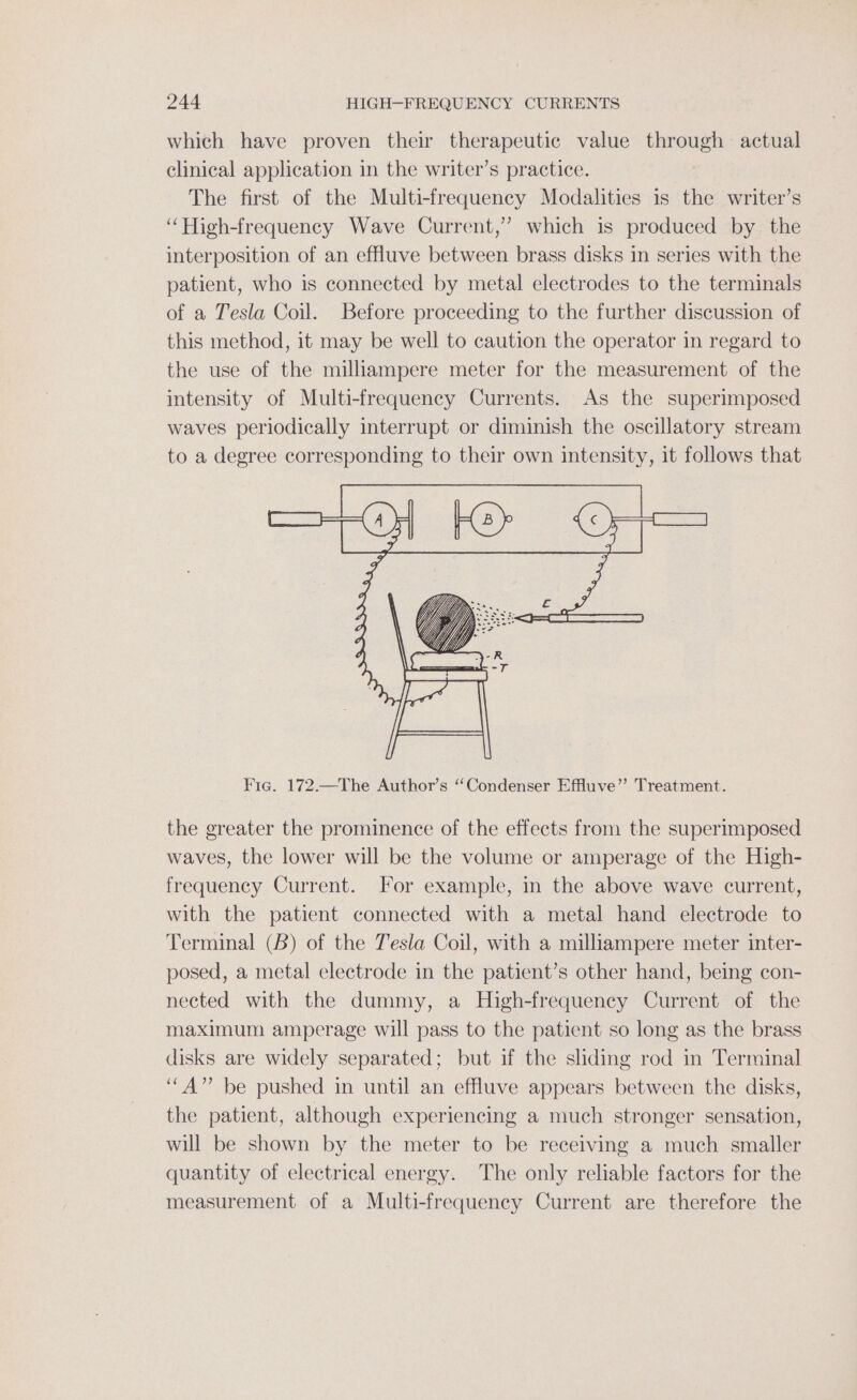 which have proven their therapeutic value through actual clinical application in the writer’s practice. The first of the Multi-frequency Modalities is the writer’s “High-frequency Wave Current,’ which is produced by the interposition of an effluve between brass disks in series with the patient, who is connected by metal electrodes to the terminals of a Tesla Coil. Before proceeding to the further discussion of this method, it may be well to caution the operator in regard to the use of the milliampere meter for the measurement of the intensity of Multi-frequency Currents. As the superimposed waves periodically interrupt or diminish the oscillatory stream to a degree corresponding to their own intensity, it follows that Fic. 172.—The Author’s “Condenser Effuve”’ Treatment. the greater the prominence of the effects from the superimposed waves, the lower will be the volume or amperage of the High- frequency Current. For example, in the above wave current, with the patient connected with a metal hand electrode to Terminal (B) of the Tesla Coil, with a milliampere meter inter- posed, a metal electrode in the patient’s other hand, being con- nected with the dummy, a High-frequency Current of the maximum amperage will pass to the patient so long as the brass disks are widely separated; but if the sliding rod in Terminal ‘““A”’ be pushed in until an effluve appears between the disks, the patient, although experiencing a much stronger sensation, will be shown by the meter to be receiving a much smaller quantity of electrical energy. The only reliable factors for the measurement of a Multi-frequency Current are therefore the