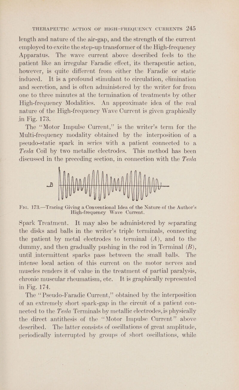 length and nature of the air-gap, and the strength of the current employed to excite the step-up transformer of the High-frequency Apparatus. The wave current above described feels to the patient hke an irregular Faradic effect, its therapeutic action, however, is quite different from either the Faradic or static induced. It 1s a profound stimulant to circulation, elimination and secretion, and is often administered by the writer for from one to three minutes at the termination of treatments by other High-frequency Modalities. An approximate idea of the real nature of the High-frequency Wave Current is given graphically in Fig. 173. The “‘Motor Impulse Current,” is the writer’s term for the Multi-frequency modality obtained by the interposition of a pseudo-static spark in series with a patient connected to a Tesla Coil by two metallic electrodes. This method has been discussed in the preceding section, in connection with the Tesla Fic. 173.—Tracing Giving a Conventional Idea of the Nature of the Author’s High-frequency Wave Current. Spark Treatment. It may also be administered by separating the disks and balls in the writer’s triple terminals, connecting the patient by metal electrodes to terminal (A), and to the dummy, and then gradually pushing in the rod in Terminal (B), until intermittent sparks pass between the small balls. The intense local action of this current on the motor nerves and muscles renders it of value in the treatment of partial paralysis, chronic muscular rheumatism, etc. It is graphically represented - in Fig. 174. The ‘‘ Pseudo-Faradic Current,” obtained by the interposition of an extremely short spark-gap in the circuit of a patient con- nected to the Tesla Terminals by metallic electrodes, is physically the direct antithesis of the ‘‘Motor Impulse Current” above described. The latter consists of oscillations of great amplitude, periodically interrupted by groups of short oscillations, while