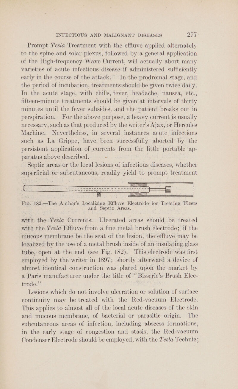Prompt Tesla Treatment with the effluve applied alternately to the spine and solar plexus, followed by a general application of the High-frequency Wave Current, will actually abort many varieties of acute infectious disease if administered sufficiently early in the course of the attack. In the prodromal stage, and the period of incubation, treatments should be given twice daily. In the acute stage, with chills, fever, headache, nausea, etc., fifteen-minute treatments should be given ‘at intervals of thirty minutes until the fever subsides, and the patient breaks out in perspiration. For the above purpose, a heavy current is usually necessary, such as that produced by the writer’s Ajax, or Hercules Machine. Nevertheless, in several instances acute infections such as La Grippe, have been successfully aborted by the persistent application of currents from the little portable ap- paratus above described. : Septic areas or the local lesions of infectious diseases, whether superficial or subcutaneous, readily yield to prompt treatment Fie. 182.—The Author’s Localizing Effluve Electrode for Treating Ulcers and Septic Areas. with the Jesla Currents. Ulcerated areas should be treated with the Tesla Effluve from a fine metal brush electrode; if the mucous membrane be the seat of the lesion, the effluve may be localized by the use of a metal brush inside of an insulating. glass tube, open at the end (see Fig. 182). This electrode was first employed by the writer in 1897; shortly afterward a device of almost identical construction was placed upon the market by a Paris manufacturer under the title of “ Bisserie’ s Brush Elec- trode.”’ | Lesions which do not involve ulceration or solution of surface continuity may be treated with the Red-vacuum Electrode. This applies to almost all of the local acute diseases of the skin and mucous membrane, of bacterial or parasitic origin. The subcutaneous areas of infection, including abscess formations, in the early stage of congestion and stasis, the Red-vacuum Condenser Electrode should be employed, with the Tesla Technic};