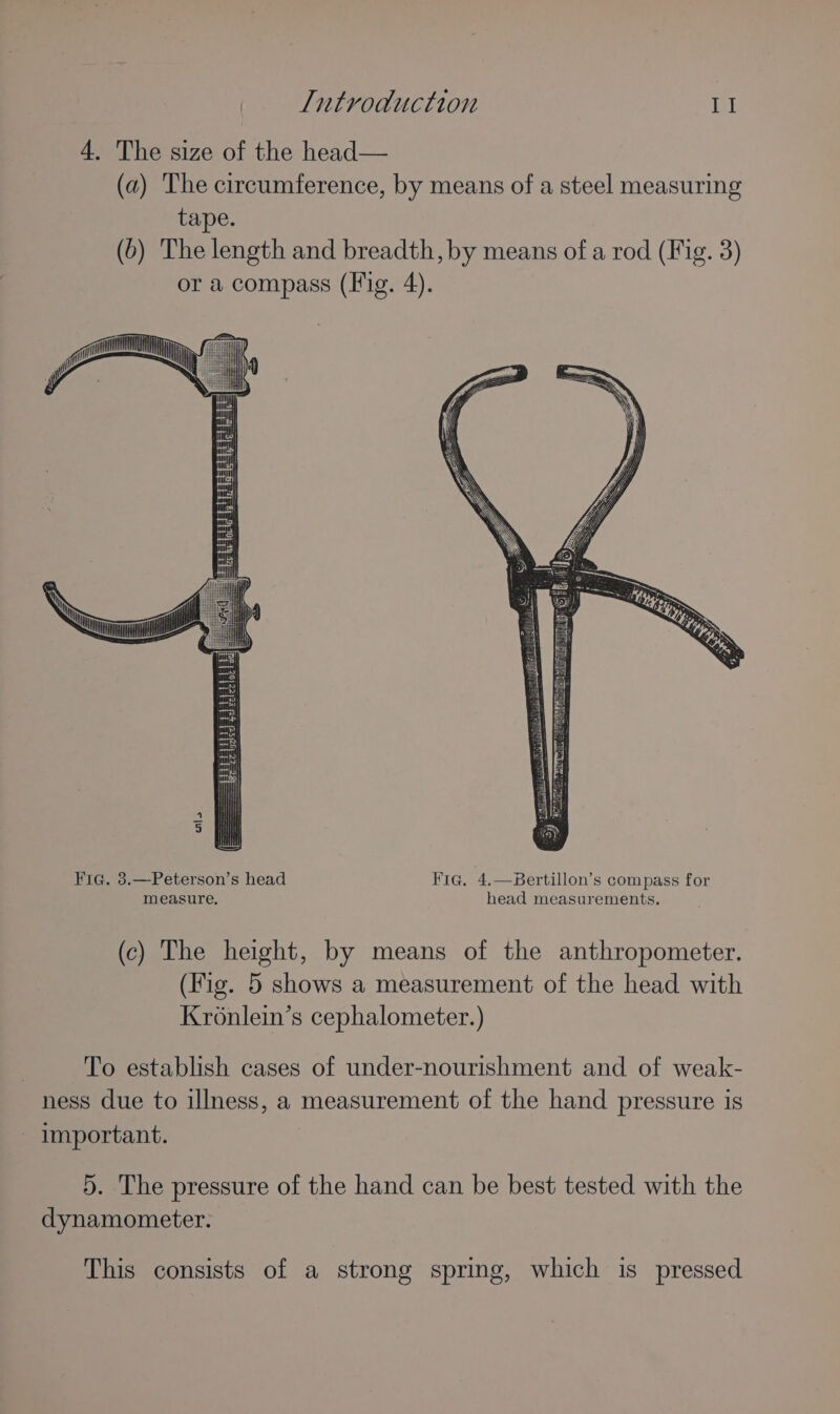 4. The size of the head— (a) The circumference, by means of a steel measuring tape. (6) The length and breadth, by means of a rod (Fig. 3) or a compass (Fig. 4). Fic. 3.—Peterson’s head Fra. 4.—Bertillon’s compass for measure. head measurements, (c) The height, by means of the anthropometer. (Fig. 5 shows a measurement of the head with Kronlein’s cephalometer.) To establish cases of under-nourishment and of weak- ness due to illness, a measurement of the hand pressure is important. 5. The pressure of the hand can be best tested with the dynamometer. This consists of a strong spring, which is pressed