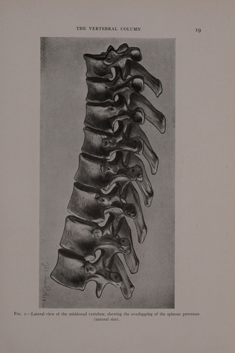 THE VERTEBRAL COLUMN Ig Fic. 2.—Lateral view of the middorsal vertebra, showing the overlapping of the spinous processes (natural size).