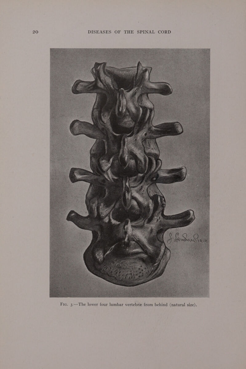 ize). d (natural s in —The lower four lumbar vertebre from behi 3 Iti,