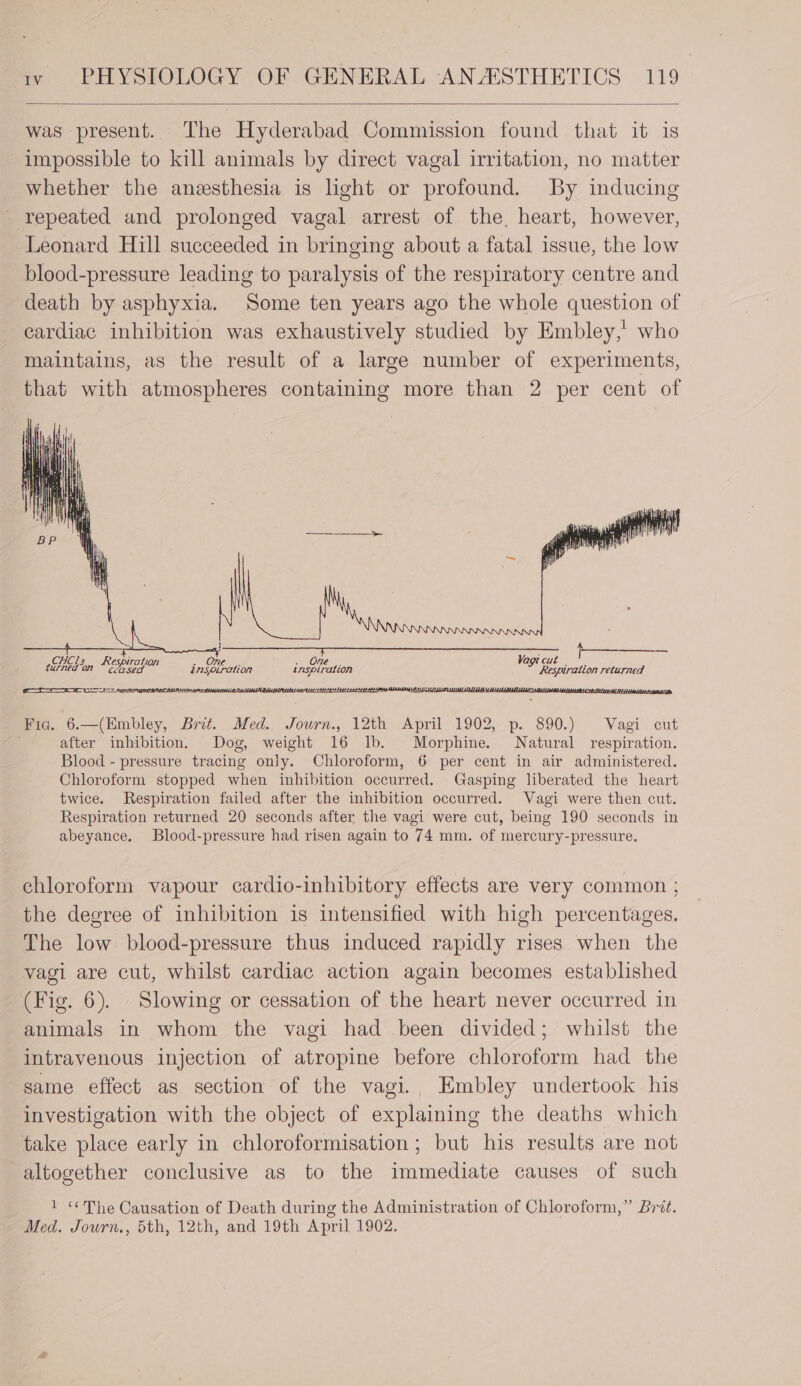 was present. The Hyderabad Commission found that it is impossible to kill animals by direct vagal irritation, no matter whether the anesthesia is light or profound. By inducing repeated and prolonged vagal arrest of the, heart, however, Leonard Hill succeeded in bringing about a fatal issue, the low blood-pressure leading to paralysis of the respiratory centre and death by asphyxia. Some ten years ago the whole question of cardiac inhibition was exhaustively studied by Embley,’ who maintains, as the result of a large number of experiments, that with atmospheres containing more than 2 per cent of Vagt c CHCl; Respiration ul. CéASE! Respiration returned aOR. Oe): turned on sed inspiration inspiration Fic. 6.—(Embley, Brit. Med.. Journ., 12th April 1902, p. 890.) Vagi cut after inhibition. Dog, weight 16 lb. Morphine. Natural respiration. Blood - pressure tracing only. Chloroform, 6 per cent in air administered. Chloroform stopped when inhibition occurred. Gasping liberated the heart twice. Respiration failed after the inhibition occurred. Vagi were then cut. Respiration returned 20 seconds after the vagi were cut, being 190 seconds in abeyance. Blood-pressure had risen again to 74 mm. of mercury-pressure. chloroform vapour cardio-inhibitory effects are very common ; the degree of inhibition is intensified with high percentages. The low blood-pressure thus induced rapidly rises when the vagi are cut, whilst cardiac action again becomes established (Fig. 6). Slowing or cessation of the heart never occurred in animals in whom the vagi had been divided; whilst the intravenous injection of atropine before chloroform had the same effect as section of the vagi., Embley undertook his investigation with the object of explaining the deaths which take place early in chloroformisation; but his results are not altogether conclusive as to the immediate causes of such 1 «The Causation of Death during the Administration of Chloroform,” Brit. Med. Jowrn., 5th, 12th, and 19th April 1902.