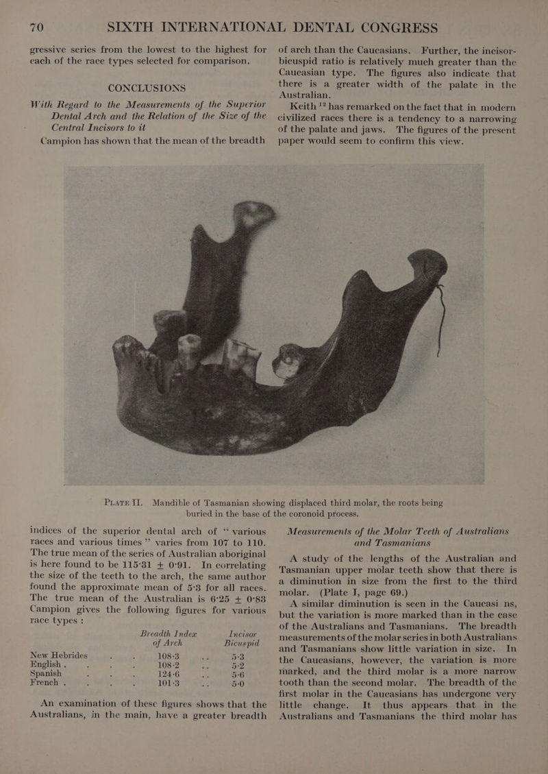 gressive series from the lowest to the highest for each of the race types selected for comparison. CONCLUSIONS With Regard to the Measurements of the Superior Dental Arch and the Relation of the Size of the Central Incisors to it Campion has shown that the mean of the breadth of arch than the Caucasians. Further, the incisor- bicuspid ratio is relatively much greater than the Caueasian type. The figures also indicate that there is a greater width of the palate in the Australian. Keith '* has remarked on the fact that in modern civilized races there is a tendency to a narrowing of the palate and jaws. The figures of the present paper would seem to confirm this view. Pare II. indices of the superior dental arch of ‘ various races and various times  varies from 107 to 110. The true mean of the series of Australian aboriginal is here found to be 115:31 + 0:91. In correlating the size of the teeth to the arch, the same author found the approximate mean of 5:3 for all races. The true mean of the Australian is 6:25 + 0:83 Campion gives the following figures for various race types: ^ Breadth Index Incisor of Arch Bicuspid New Hebrides 108-3 5-3 English . 108-2 5:2 Spanish 124-6 5:6 French . 101-3 5:0 An examination of these figures shows that the Australians, in the main, have a greater breadth Measurements of the Molar Teeth of Australians and Tasmanians A study of the lengths of the Australian and Tasmanian upper molar teeth show that there is a diminution in size from the first to the third molar. (Plate I, page 69.) A similar diminution is seen in the Caucasi ns, but the variation is more marked than in the case of the Australians and Tasmanians. The breadth measurements of the molar series in both Australians and Tasmanians show little variation in size. In the Caucasians, however, the variation is more marked, and the third molar is a more narrow tooth than the second molar. The breadth of the first molar in the Caucasians has undergone very little change. It thus appears that in the Australians and Tasmanians the third molar has