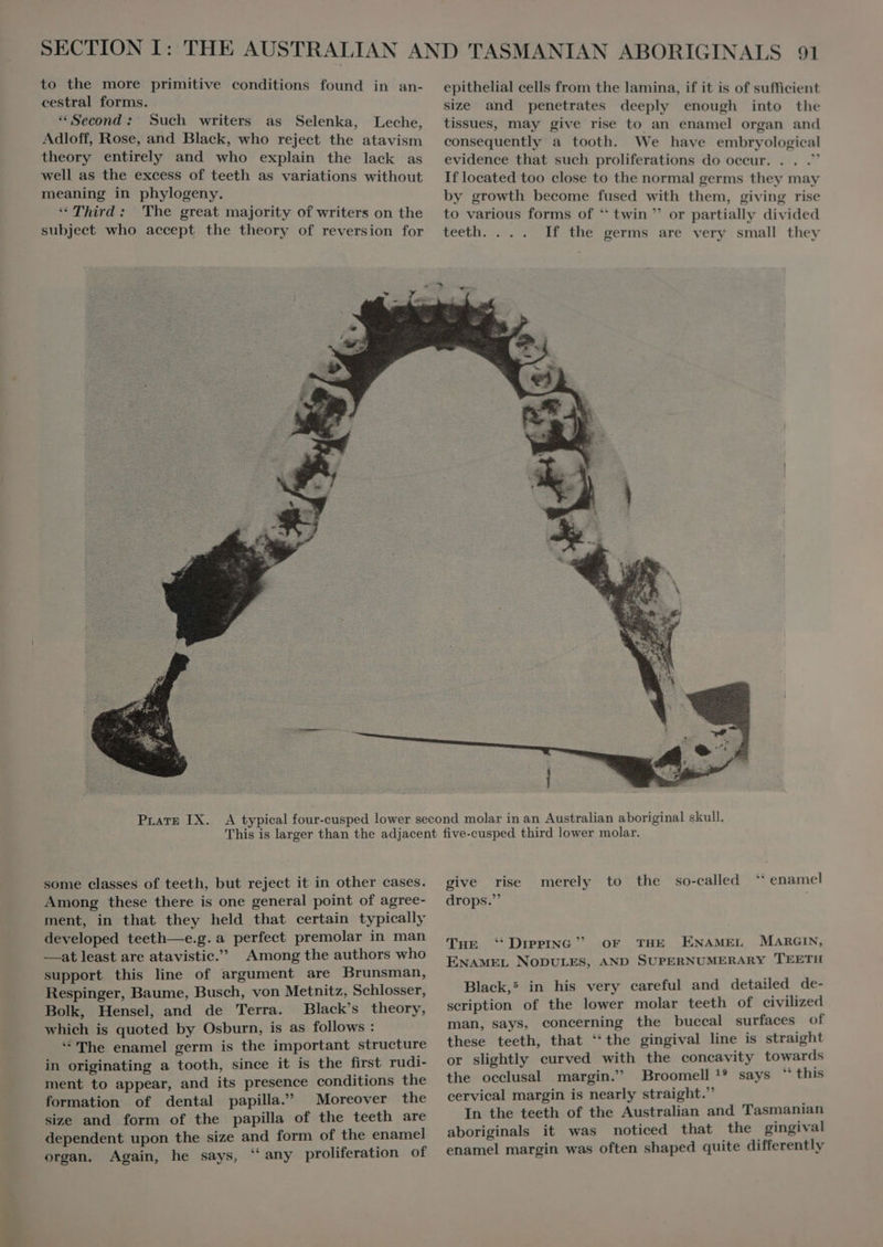 cestral forms. Second: Such writers as Selenka, Leche, Adloff, Rose, and Black, who reject the atavism theory entirely and who explain the lack as well as the excess of teeth as variations without meaning in phylogeny. “Third: The great majority of writers on the subject who accept the theory of reversion for PLATE IX. some classes of teeth, but reject it in other cases. Among these there is one general point of agree- ment, in that they held that certain typically developed teeth—e.g. a perfect premolar in man —at least are atavistic. Among the authors who support this line of argument are Brunsman, Respinger, Baume, Busch, von Metnitz, Schlosser, Bolk, Hensel, and de Terra. Black’s theory, which is quoted by Osburn, is as follows : * The enamel germ is the important structure in originating a tooth, since it is the first rudi- ment to appear, and its presence conditions the formation of dental papilla. Moreover the size and form of the papilla of the teeth are dependent upon the size and form of the enamel organ. Again, he says, “any proliferation of size and penetrates deeply enough into the tissues, may give rise to an enamel organ and consequently a tooth. We have embryological evidence that such proliferations do occur. . . . If located too close to the normal germs they may by growth become fused with them, giving rise to various forms of * twin  or partially divided teeth. . . . If the germs are very small they * enamel give rise merely to the so-called drops. THE ‘ DIPPING”? OF THE ENAMEL MARGIN, ENAMEL NODULES, AND SUPERNUMERARY TEETH Black,5 in his very careful and detailed de- scription of the lower molar teeth of civilized man, says, concerning the buccal surfaces of these teeth, that ‘the gingival line is straight or slightly curved with the concavity towards the occlusal margin. Broomell !? says “ this cervical margin is nearly straight.” In the teeth of the Australian and Tasmanian aboriginals it was noticed that the gingival enamel margin was often shaped quite differently