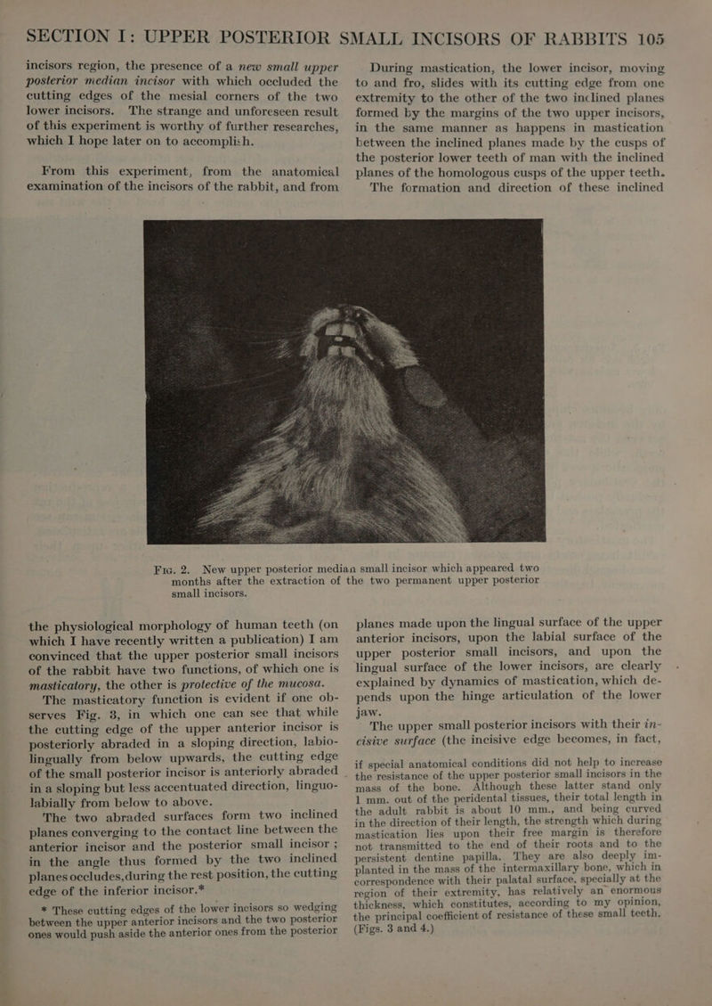 incisors region, the presence of a new small upper posterior median incisor with which occluded the cutting edges of the mesial corners of the two lower incisors. The strange and unforeseen result of this experiment is worthy of further researches, which I hope later on to accomplish. From this experiment, from the anatomieal examination of the incisors of the rabbit, and from During mastication, the lower incisor, moving to and fro, slides with its cutting edge from one extremity to the other of the two inclined planes formed by the margins of the two upper incisors, in the same manner as happens in mastication between the inclined planes made by the cusps of the posterior lower teeth of man with the inclined planes of the homologous cusps of the upper teeth. The formation and direction of these inclined the physiological morphology of human teeth (on which I have recently written a publication) I am convinced that the upper posterior small incisors masticatory, the other is protective of the mucosa. The masticatory function is evident if one ob- serves Fig. 3, in which one can see that while the cutting edge of the upper anterior incisor is posteriorly abraded in a sloping direction, labio- lingually from below upwards, the eutting edge in a sloping but less accentuated direction, linguo- labially from below to above. The two abraded surfaces form two inclined planes converging to the contact line between the anterior incisor and the posterior small incisor ; in the angle thus formed by the two inclined planes occludes, during the rest position, the cutting edge of the inferior incisor.* * These cutting edges of the lower incisors so wedging between the upper anterior incisors and the two posterior ones would push aside the anterior ones from the posterior planes made upon the lingual surface of the upper anterior incisors, upon the labial surface of the upper posterior small incisors, and upon the lingual surface of the lower incisors, are clearly explained by dynamics of mastication, which de- pends upon the hinge articulation of the lower jaw. The upper small posterior incisors with their in- cisive surface (the incisive edge becomes, in fact, if special anatomical conditions did not help to increase the resistance of the upper posterior small incisors in the mass of the bone. Although these latter stand only 1 mm. out of the peridental tissues, their total length in the adult rabbit is about 10 mm., and being curved in the direction of their length, the strength which during mastication lies upon their free margin is therefore not transmitted to the end of their roots and to the persistent dentine papilla. They are also deeply im- planted in the mass of the intermaxillary bone, which in correspondence with their palatal surface, specially at the region of their extremity, has relatively an enormous thickness, which constitutes, according to my opinion, the principal coefficient of resistance of these small teeth. (Figs. 3 and 4.)