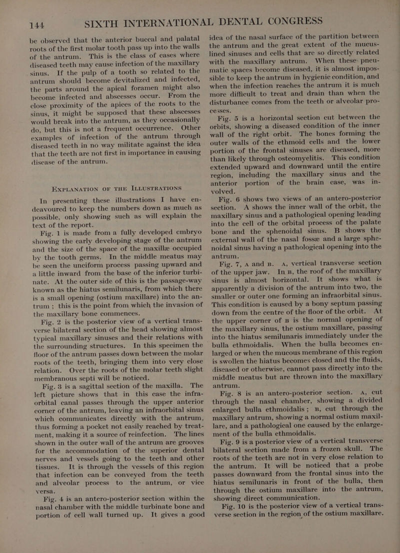 be observed that the anterior buccal and palatal roots of the first molar tooth pass up into the walls of the antrum. This is the class of cases where diseased teeth may cause infection of the maxillary sinus. If the pulp of a tooth so related to the antrum should become devitalized and infected, the parts around the apical foramen might also become infected and abscesses occur. From the close proximity of the apices of the roots to the sinus, it might be supposed that these abscesses would break into the antrum, as they occasionally do, but this is not a frequent occurrence. Other examples of infection of the antrum through diseased teeth in no way militate against the idea that the teeth are not first in importance in causing disease of the antrum. EXPLANATION OF THE ILLUSTRATIONS In presenting these illustrations I have en- deavoured to keep the numbers down as much as possible, only showing such as will explain the text of the report. | Fig. 1 is made from a fully developed embryo showing the early developing stage of the antrum and the size of the space of the maxillæ occupied by the tooth germs. In the middle meatus may be seen the unciform process passing upward and alittle inward from the base of the inferior turbi- nate. At the outer side of this is the passage-way known as the hiatus semilunaris, from which there is a small opening (ostium maxillare) into the an- trum ; this is the point from which the invasion of the maxillary bone commences. Fig. 2 is the posterior view of a vertical trans- verse bilateral section of the head showing almost typical maxillary sinuses and their relations with the surrounding structures. In this specimen the floor of the antrum passes down between the molar roots of the teeth, bringing them into very close relation. Over the roots of the molar teeth slight membranous septi will be noticed. Fig. 3 is a sagittal section of the maxilla. The left picture shows that in this case the infra- orbital canal passes through the upper anterior corner of the antrum, leaving an infraorbital sinus which communicates directly with the antrum, thus forming a pocket not easily reached by treat- ment, making it a source of reinfection. The lines shown in the outer wall of the antrum are grooves for the aecommodation of the superior dental nerves and vessels going to the teeth and other tissues. It is through the vessels of this region that infection can be conveyed from the teeth and alveolar process to the antrum, or vice versa. Fig. 4 is an antero-posterior section within the nasal chamber with the middle turbinate bone and portion of cell wall turned up. It gives a good idea of the nasal surface of the partition between the antrum and the great extent of the mucus- lined sinuses and cells that are so directly related with the maxillary antrum. When these- pneu- matic spaces become diseased, it is almost impos- sible to keep theantrum in hygienie condition, and when the infection reaches the antrum it is much more difficult to treat and drain than when the disturbance comes from the teeth or alveolar pro- cesses. Fig. 5 is a horizontal section cut between the orbits, showing a diseased condition of the inner wall of the right orbit. 'The bones forming the outer walls of the ethmoid cells and the lower portion of the frontal sinuses are diseased, more than likely through osteomyelitis. This condition extended upward and downward until the entire region, including the maxillary sinus and the anterior portion of the brain case, was in- volved. Fig. 6 shows two views of an antero-posterior section. A shows the inner wall of the orbit, the maxillary sinus and a pathological opening leading into the cell of the orbital process of the palate bone and the sphenoidal sinus. B shows the external wall of the nasal fosse and a large sphe- noidal sinus having a pathological opening into the antrum. Fig. 7, a and B. A, vertical transverse section of the upper jaw. In B, the roof of the maxillary sinus is almost horizontal. It shows what is apparently a division of the antrum into two, the smaller or outer one forming an infraorbital sinus. This condition is caused by a bony septum passing down from the centre of the floor of the orbit. At the upper corner of B is the normal opening of the maxillary sinus, the ostium maxillare, passing into the hiatus semilunaris immediately under the When the bulla becomes en- larged or when the mucous membrane of this region is swollen the hiatus becomes closed and the fluids, diseased or otherwise, cannot pass directly into the middle meatus but are thrown into the maxillary antrum. Fig. 8 is an antero-posterior section. A, cut through the nasal chamber, showing a divided enlarged bulla ethmoidalis; B, cut through the maxillary antrum, showing a normal ostium maxil- lare, and a pathological one caused by the enlarge- ment of the bulla ethmoidalis. Fig. 9 is a posterior view of a vertical transverse bilateral section made from a frozen skull. The roots of the teeth are not in very close relation to the antrum. It will be noticed that a probe passes downward from the frontal sinus into the hiatus semilunaris in front of the bulla, then through the ostium maxillare into the antrum, showing direct communication. Fig. 10 is the posterior view of a vertical trans- verse section in the region of the ostium maxillare.