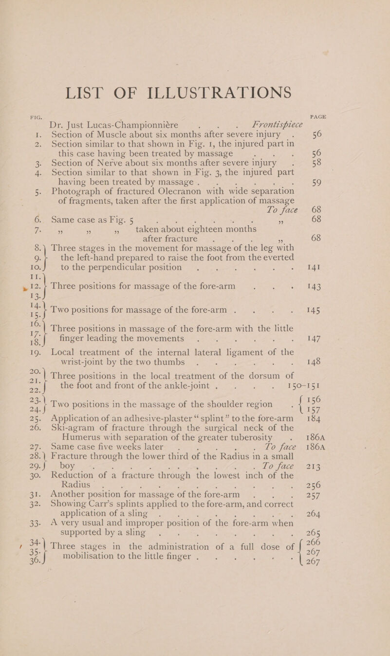 Lisl OF TELUSTRATIONS RIG. PAGE Dr. Just Lucas- Championniére : . Lrontisprece Section of Muscle about six months after severe injury 56 Section similar to that shown in Fig. 1, the injured part in this case having been treated by massage 3 56 3. Section of Nerve about six months after severe injury 53 4. Section similar to that shown in Fig. 3, the injured part having been treated by massage . 59 5 Photograph of fractured Olecranon with wide separation of fragments, taken after the first application of massage LO face «68 6.. Same case as Fig. 5 Geet: 525+, eine =e oe &amp; 68 Te - 4 , taken about eighteen months after fracture 68 8.) Three stages in the movement for massage ‘of the leg with 2} the left-hand prepared to raise the foot from the everted IO. to the perpendicular position I4I ee » 2 Three positions for massage of the fore-arm 143 r3. Two positions for massage of the fore-arm . 145 es z Three positions in massage of the fore-arm with the little ve finger leading the movements 147 Pe Local treatment of the internal lateral hgament of the wrist-joint by the two thumbs 148 ce Three positions in the local treatment of the dorsum of ao) the foot and front of the ankle-joint . : ; ye oS! sat Two positions in the massage of the shoulder region : { ee 25. Application of an adhesive-plaster “splint” tothe fore-arm 184 26. Ski-agram of fracture through the surgical neck of the Humerus with separation of the greater tuberosity 186A 272 Same. case five-weeksdater- - -; sf O face, T3868 28.\ Fracture through the lower third of the Radius in a small 29. boy ; LO faée”- 203 30. Reduction of a fracture through the lowest inch of the Radius 256 31. Another position for massage of the fore-arm ahr ae aC 32. Showing Carr’s splints applied to the fore-arm, and correct application of a sling 264 33. A very usual and improper position of the fore-arm when supported by a sling Se Ds 265 ee Three stages in the administration of a full dose of a 36. mobilisation to the little finger . a