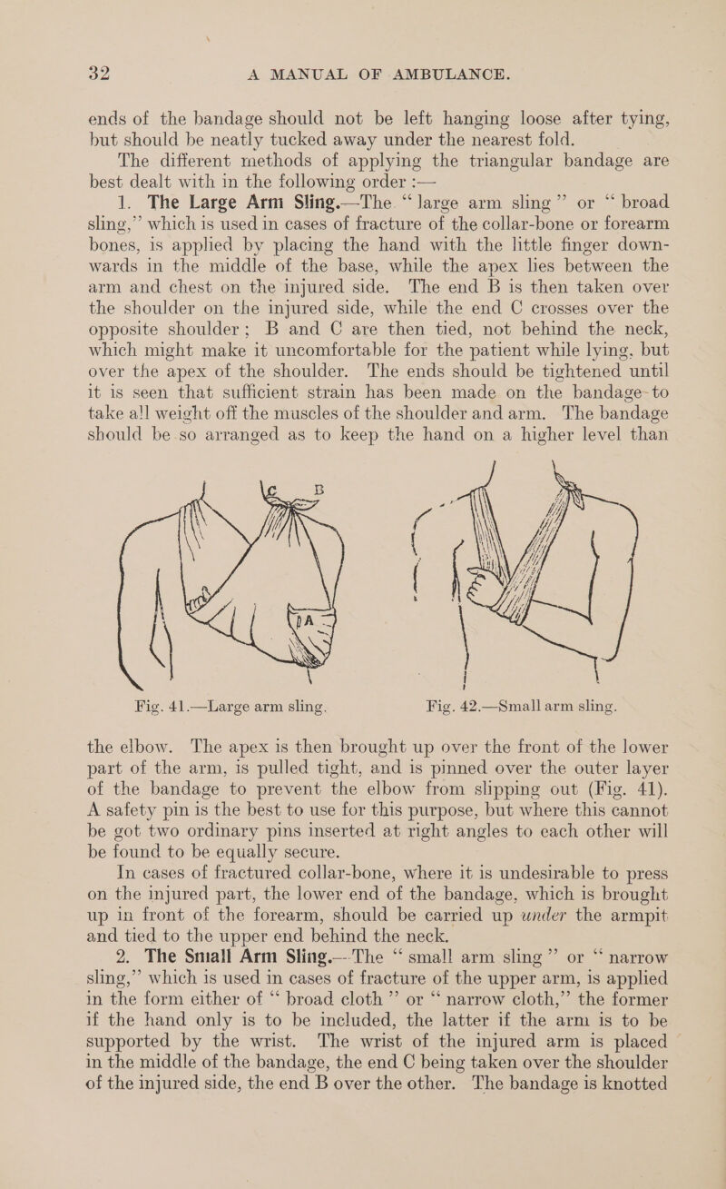 ends of the bandage should not be left hanging loose after tying, but should be neatly tucked away under the nearest fold. The different methods of applying the triangular bandage are best dealt with in the following order :— 1. The Large Arm Sling.—The “large arm sling” or “ broad sling,’ which is used in cases of fracture of the collar-bone or forearm bones, is applied by placing the hand with the little finger down- wards in the middle of the base, while the apex lies between the arm and chest on the injured side. The end B is then taken over the shoulder on the injured side, while the end C crosses over the opposite shoulder; B and C are then tied, not behind the neck, which might make it uncomfortable for the patient while lying, but over the apex of the shoulder. The ends should be tightened until it is seen that sufficient strain has been made on the bandage-to take a!l weight off the muscles of the shoulder and arm. The bandage should be so arranged as to keep the hand on a higher level than the elbow. The apex 1s then brought up over the front of the lower part of the arm, is pulled tight, and is pinned over the outer layer of the bandage to prevent the elbow from slipping out (Fig. 41). A safety pin is the best to use for this purpose, but where this cannot be got two ordinary pins inserted at mght angles to each other will be found to be equally secure. In cases of fractured collar-bone, where it is undesirable to press on the injured part, the lower end of the bandage, which is brought up in front of the forearm, should be carried up under the armpit and tied to the upper end behind the neck. 2. The Small Arm Sling.—-The “smal! arm sling” or “ narrow sling,” which is used in cases of fracture of the upper arm, is applied in the form either of “ broad cloth ” or “‘ narrow cloth,”’ the former if the hand only is to be included, the latter if the arm is to be supported by the wrist. The wrist of the injured arm is placed | in the middle of the bandage, the end C being taken over the shoulder of the injured side, the end B over the other. The bandage is knotted