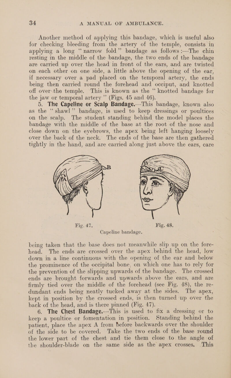 Another method of applying this bandage, which is useful also for checking bleeding from the artery of the temple, consists in applying a long “narrow fold” bandage as follows :—-The chin resting in the middle of the bandage, the two ends of the bandage are carried up over the head in front of the ears, and are twisted on each other on one side, a little above the opening of the ear, if necessary over a pad placed on the temporal artery, the ends being then carried round the forehead and occiput, and knotted off over'the temple. This is known as the “ knotted bandage for the jaw or temporal artery ” (Figs. 45 and 46). 5. The Capeline or Scalp Bandage.—This bandage, known also as the “shawl” bandage, is used to keep dressings or poultices on the scalp. The student standing behind the model places the bandage with the middle of the base at the root of the nose and close down on the eyebrows, the apex beimg left hanging loosely over the hack of the neck. The ends of the base are then gathered tightly in the hand, and are carried along just above the ears, care being taken that the base does not meanwhile slp up on the fore- head. The ends are crossed over the apex.behind the head, low down in a line continuous with the opening of the ear and below the prominence of the occipital bone, on which one has to rely for the prevention of the slipping upwards of the bandage. The crossed ends are brought forwards and upwards above the ears. and are firmly tied over the middle of the forehead (see Fig. 48), the re- dundant ends being neatly tucked away at the sides. The apex, kept in position by the crossed ends, is then turned up over the back of the head, and is there pinned (Fig. 47). 6. The Chest Bandage.—This is used to fix a dressing or to keep a poultice or fomentation in position. Standing behind the patient, place the apex A from before backwards over the shoulder of the side to be covered. Take the two ends of the base round the lower part of the chest and tie them close to the angle of the shoulder-blade on the same side as the apex crosses. This