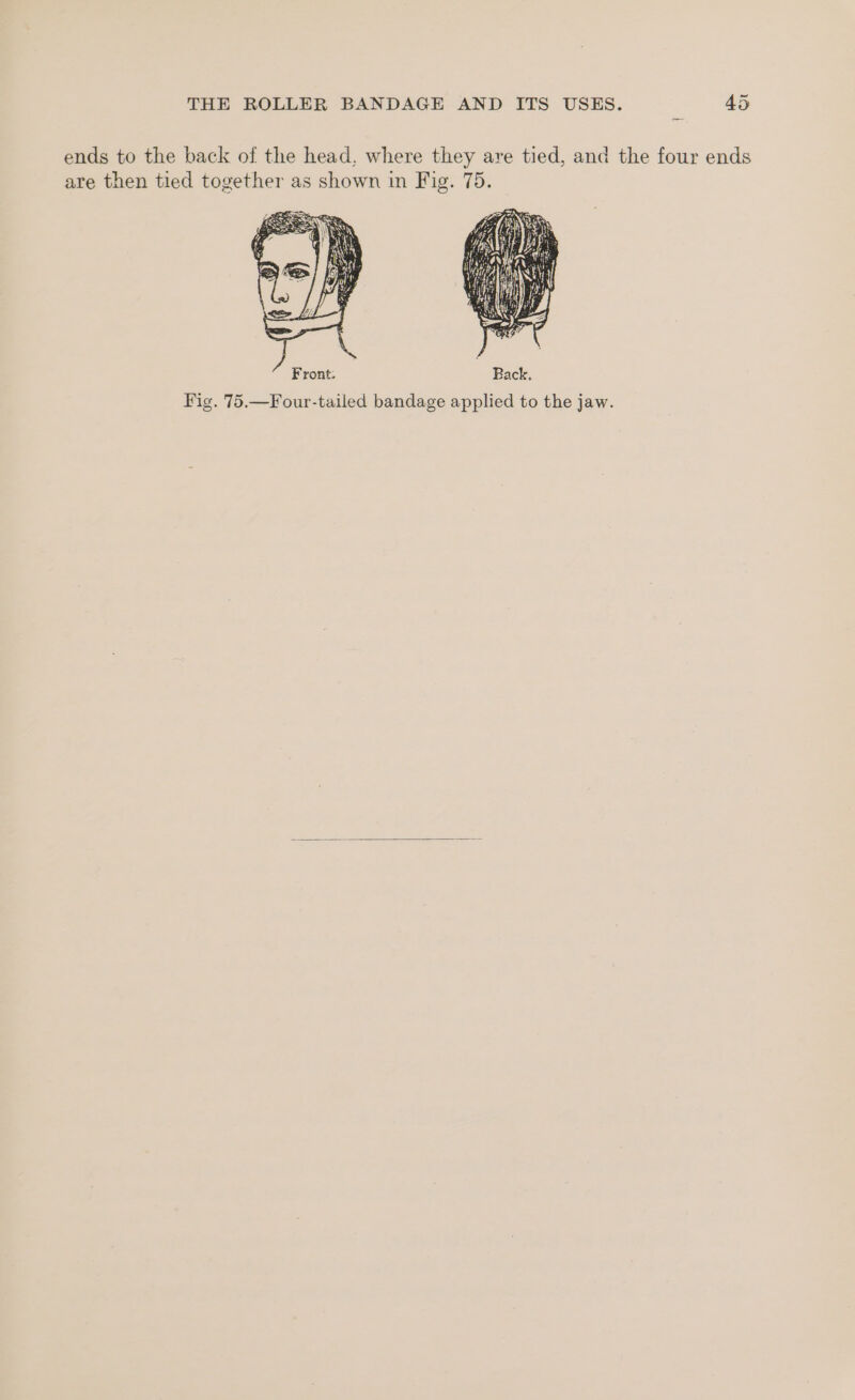 ends to the back of the head, where they are tied, and the four ends are then tied together as shown in Fig. 75. mES NS if es if Ke We Ny Ye \ i he Se