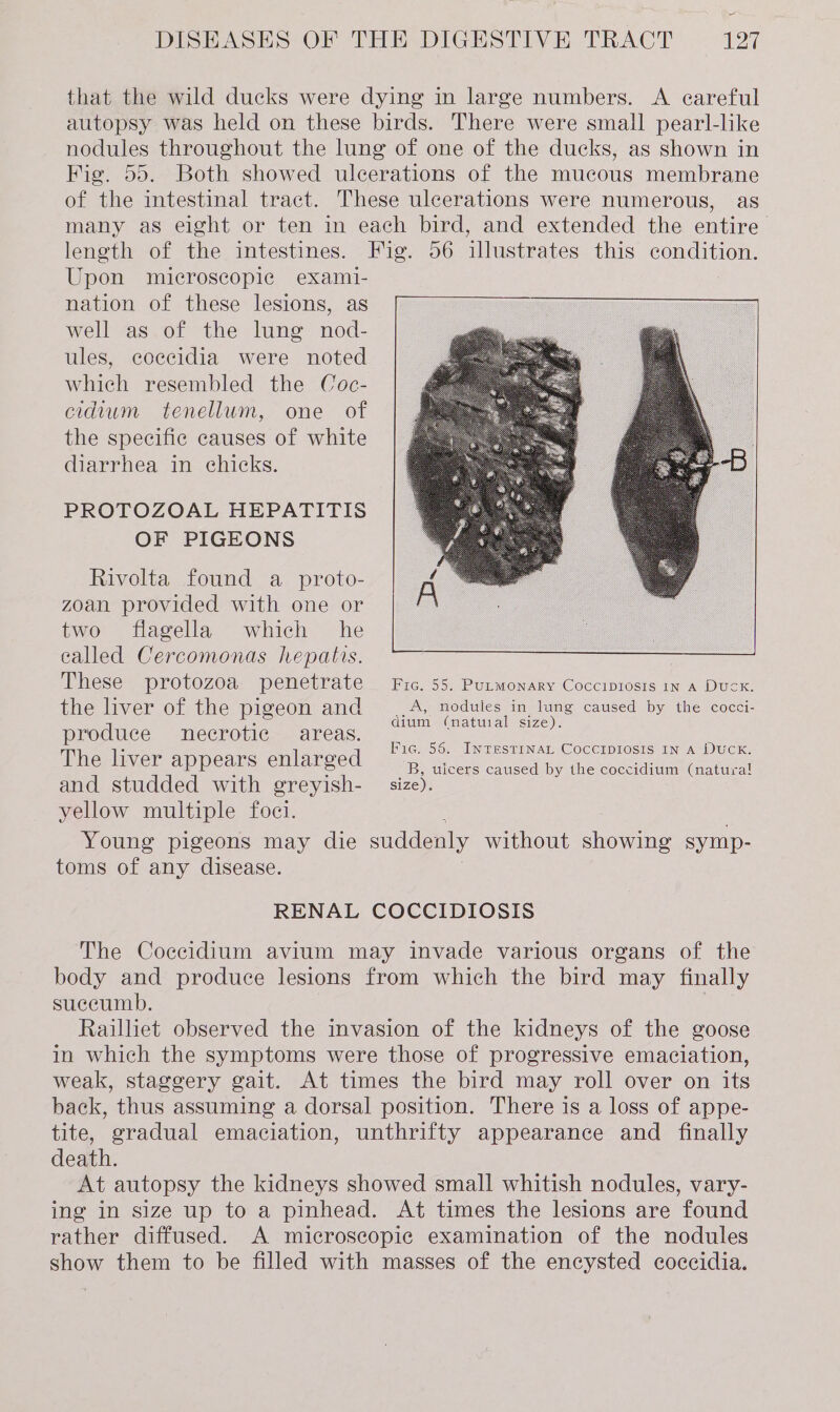 = DISEASES OF THE DIGESTIVE TRACT 127 that the wild ducks were dying in large numbers. A careful autopsy was held on these birds. There were small pearl-like nodules throughout the lung of one of the ducks, as shown in Fig. 55. Both showed ulcerations of the mucous membrane of the intestinal tract. These ulcerations were numerous, as many as eight or ten in each bird, and extended the entire length of the intestines. Fig. 56 illustrates this condition. Upon microscopic exami- nation of these lesions, as well as of the lung nod- ules, coccidia were noted which resembled the Coc- cidum tenellum, one of the specific causes of white diarrhea in chicks. PROTOZOAL HEPATITIS OF PIGEONS Rivolta found a proto- zoan provided with one or two flagella which he ealled Cercomonas hepatis. These protozoa penetrate Fic. 55. Putmonary Cocciprosis 1n a Duck. the liver of the pigeon and A, nodules in lung caused by the cocci- ae dium (natural size). produce necrotic areas. Dis ea aa pare eniarocd Fig. 56. INTESTINAL COCCIDIOSIS IN A DUCK. Pp 8 t B, ulcers caused by the coccidium (natural! and studded with greyish- | size). yellow multiple foci. Young pigeons may die suddenly without showing symp- toms of any disease. RENAL COCCIDIOSIS The Coccidium avium may invade various organs of the body and produce lesions from which the bird may finally succumb. Railliet observed the invasion of the kidneys of the goose in which the symptoms were those of progressive emaciation, weak, staggery gait. At times the bird may roll over on its back, thus assuming a dorsal position. There is a loss of appe- tite, gradual emaciation, unthrifty appearance and _ finally death. At autopsy the kidneys showed small whitish nodules, vary- ing in size up to a pinhead. At times the lesions are found rather diffused. A microscopic examination of the nodules show them to be filled with masses of the encysted coccidia.