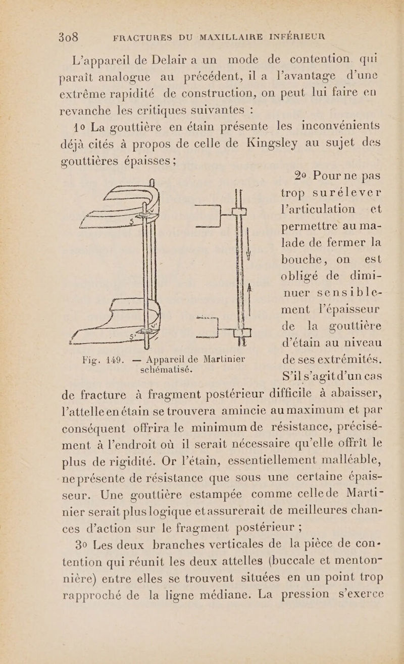 L'appareil de Delair a un mode de contention. qui paraît analogue au précédent, il a l’avantage d’une extrême rapidité de construction, on peut lui faire en revanche les critiques suivantes : 19 La gouttière en étain présente les inconvénients déjà cités à propos de celle de Kingsley au sujet des gouttières épaisses ; 29 Pour ne pas trop surélever l’articulation et permettre au ma- lade de fermer la bouche, on est obligé de dimi- nuer sensible- ment l'épaisseur de la gouttière d’étain au niveau Fig. 149. — Appareil de Martinier de ses extrémités. schématisé. S'ils’agit d’un cas de fracture à fragment postérieur difficile à abaisser, l’attelleenétain setrouvera amincie au maximum et par conséquent offrira le minimum de résistance, précisé- ment à l’endroit où il serait nécessaire qu'elle offrit le plus de rigidité. Or l’étain, essentiellement malléable, neprésente de résistance que sous une certaine épais- seur. Une gouttière estampée comme cellede Marti- nier serait plus logique etassurerait de meilleures chan- ces d'action sur le fragment postérieur ; 30 Les deux branches verticales de la pièce de con- tention qui réunit les deux attelles (buccale et menton- nière) entre elles se trouvent situées en un point trop rapproché de la ligne médiane. La pression s'exerce