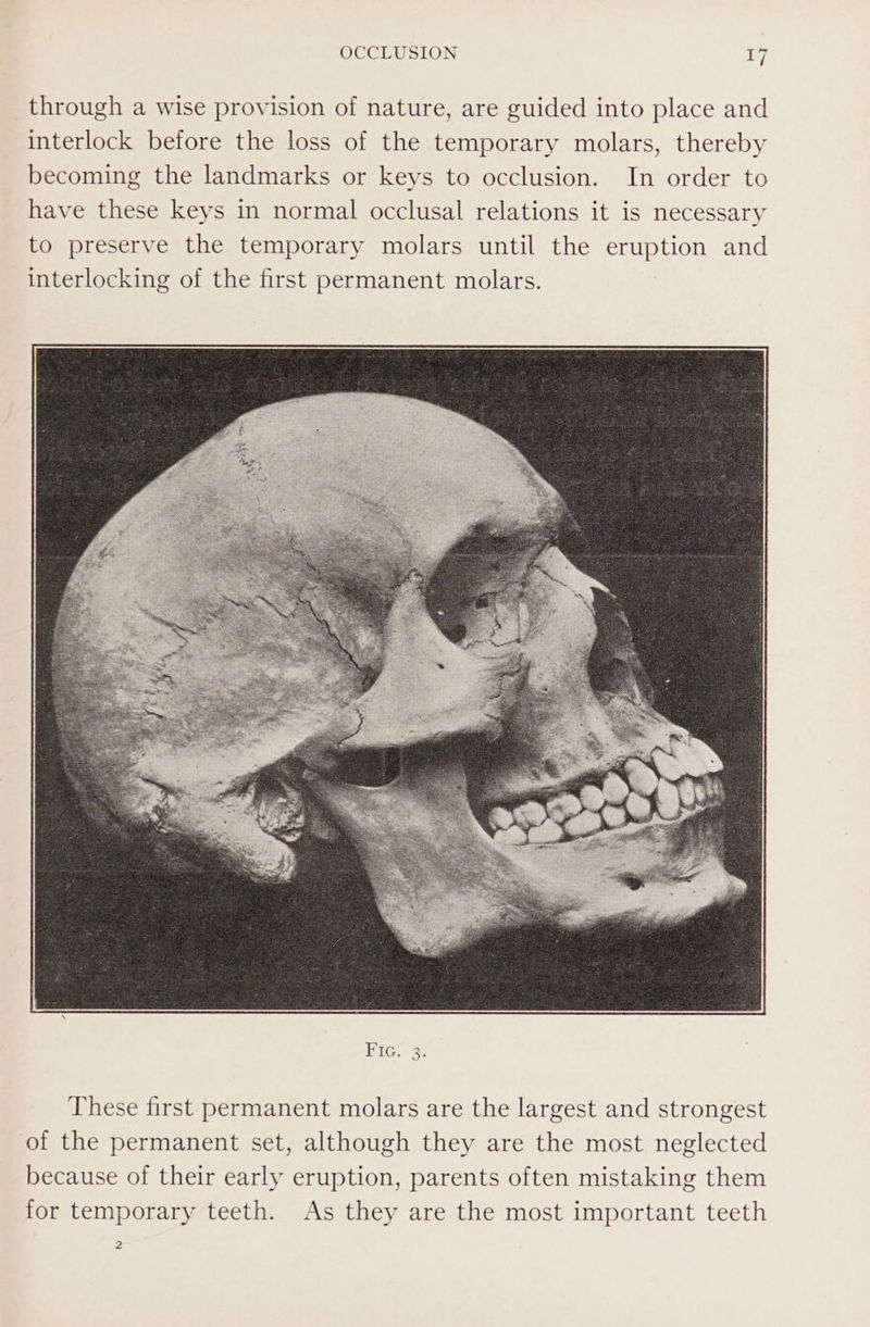 through a wise provision of nature, are guided into place and interlock before the loss of the temporary molars, thereby becoming the landmarks or keys to occlusion. In order to have these keys in normal occlusal relations it is necessary to preserve the temporary molars until the eruption and interlocking of the first permanent molars. These first permanent molars are the largest and strongest of the permanent set, although they are the most neglected because of their early eruption, parents often mistaking them for temporary teeth. As they are the most important teeth 2