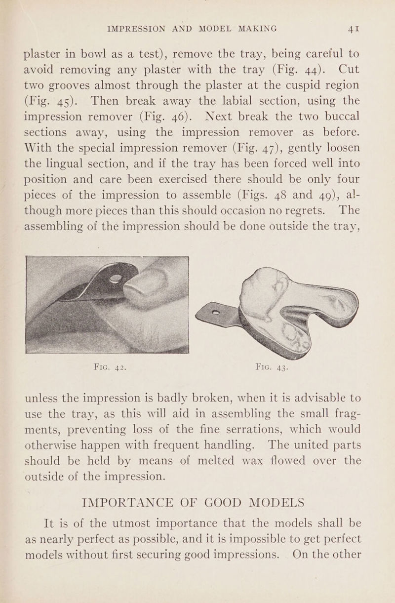 plaster in bowl as a test), remove the tray, being careful to avoid removing any plaster with the tray (Fig. 44). Cut two grooves almost through the plaster at the cuspid region (Fig. 45). Then break away the labial section, using the impression remover (Fig. 46). Next break the two buccal sections away, using the impression remover as_ before. With the special impression remover (Fig. 47), gently loosen the lingual section, and if the tray has been forced well into position and care been exercised there should be only four pieces of the impression to assemble (Figs. 48 and 49), al- though more pieces than this should occasion no regrets. The assembling of the impression should be done outside the tray, unless the impression is badly broken, when it is advisable to use the tray, as this will aid in assembling the small frag- ments, preventing loss of the fine serrations, which would otherwise happen with frequent handling. The united parts should be held by means of melted wax flowed over the outside of the impression. IMPORTANCE OF GOOD MODELS It is of the utmost Importance that the models shall be as nearly perfect as possible, and it is impossible to get perfect models without first securing good impressions. On the other