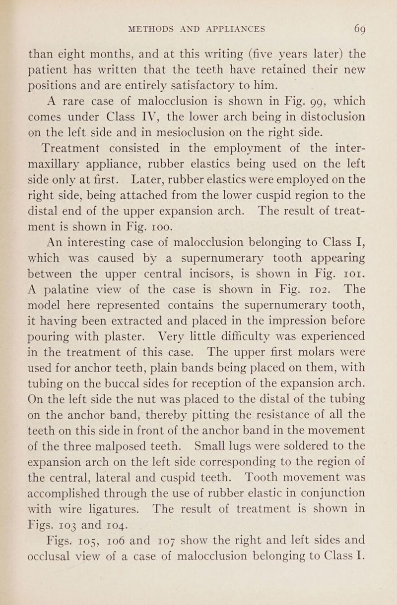 than eight months, and at this writing (five years later) the patient has written that the teeth have retained their new positions and are entirely satisfactory to him. A rare case of malocclusion is shown in Fig. 99, which comes under Class IV, the lower arch being in distoclusion on the left side and in mesioclusion on the right side. Treatment consisted in the employment of the inter- maxillary appliance, rubber elastics being used on the left side only at first. Later, rubber elastics were employed on the right side, being attached from the lower cuspid region to the distal end of the upper expansion arch. ‘The result of treat- ment is shown in Fig. roo. An interesting case of malocclusion belonging to Class I, which was caused by a supernumerary tooth appearing between the upper central incisors, is shown in Fig. rot. Mepaiatine iew oo: the case is«shown in Vig. 102). “Phe model here represented contains the supernumerary tooth, it having been extracted and placed in the impression before pouring with plaster. Very little difficulty was experienced in the treatment of this case. The upper first molars were used for anchor teeth, plain bands being placed on them, with tubing on the buccal sides for reception of the expansion arch. On the left side the nut was placed to the distal of the tubing on the anchor band, thereby pitting the resistance of all the teeth on this side in front of the anchor band in the movement of the three malposed teeth. Small lugs were soldered to the expansion arch on the left side corresponding to the region of the central, lateral and cuspid teeth. Tooth movement was accomplished through the use of rubber elastic in conjunction with wire ligatures. The result of treatment is shown in Figs. 103 and 104. Figs. 105, 106 and 107 show the right and left sides and occlusal view of a case of malocclusion belonging to Class I.