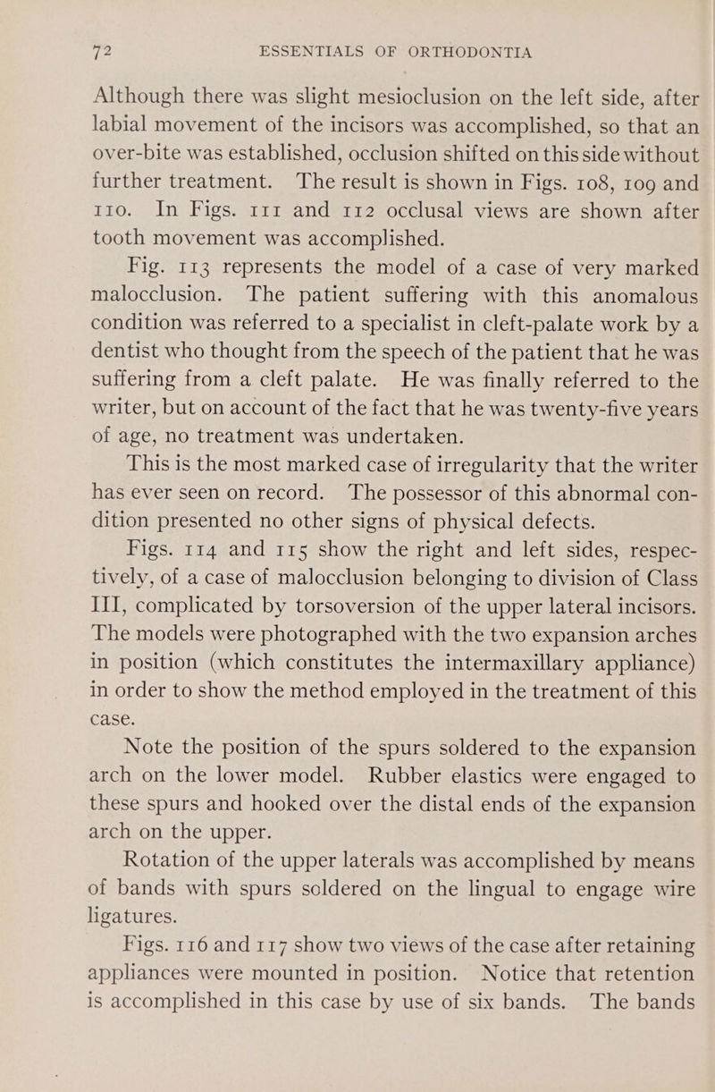 Although there was slight mesioclusion on the left side, after labial movement of the incisors was accomplished, so that an over-bite was established, occlusion shifted on this side without further treatment. ‘The result is shown in Figs. 108, 10g and 110. In Figs. 11 and 112 occlusal views are shown after tooth movement was accomplished. Fig. 113 represents the model of a case of very marked malocclusion. The patient suffering with this anomalous condition was referred to a specialist in cleft-palate work by a dentist who thought from the speech of the patient that he was suffering from a cleft palate. He was finally referred to the writer, but on account of the fact that he was twenty-five years of age, no treatment was undertaken. This is the most marked case of irregularity that the writer has ever seen on record. ‘The possessor of this abnormal con- dition presented no other signs of physical defects. Figs. 114 and 115 show the right and left sides, respec- tively, of a case of malocclusion belonging to division of Class III, complicated by torsoversion of the upper lateral incisors. The models were photographed with the two expansion arches in position (which constitutes the intermaxillary appliance) in order to show the method employed in the treatment of this case. Note the position of the spurs soldered to the expansion arch on the lower model. Rubber elastics were engaged to these spurs and hooked over the distal ends of the expansion arch on the upper. Rotation of the upper laterals was accomplished by means of bands with spurs soldered on the lingual to engage wire ligatures. Figs. 116 and 117 show two views of the case after retaining appliances were mounted in position. Notice that retention is accomplished in this case by use of six bands. The bands