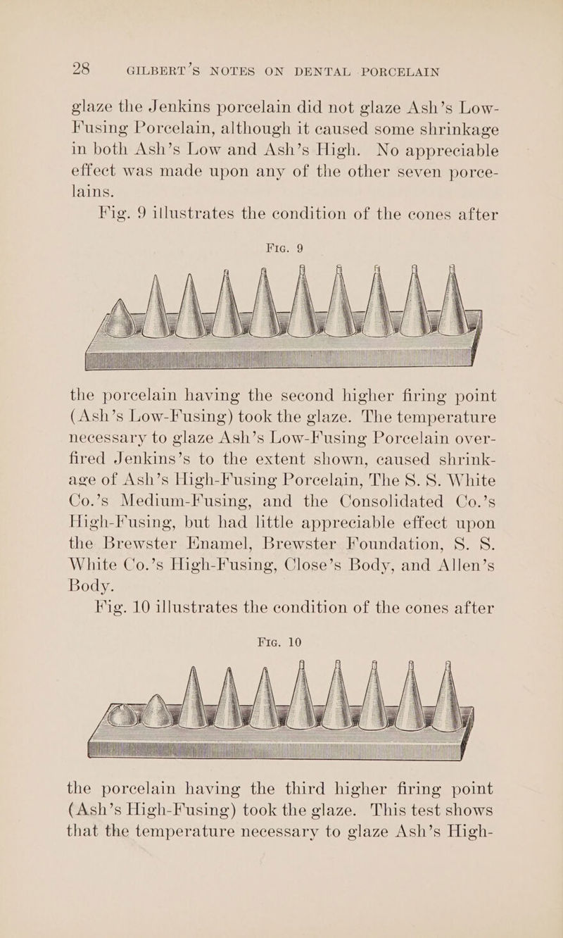 glaze the Jenkins porcelain did not glaze Ash’s Low- Fusing Porcelain, although it caused some shrinkage in both Ash’s Low and Ash’s High. No appreciable effect was made upon any of the other seven porce- lains. Fig. 9 illustrates the condition of the cones after iii iii the porcelain having the second higher firing point (Ash’s Low-Fusing) took the glaze. The temperature necessary to glaze Ash’s Low-F using Porcelain over- fired Jenkins’s to the extent shown, caused shrink- age of Ash’s High-Fusing Porcelain, The S. S. White Co.’s Medium-F using, and the Consolidated Co.’s High-Fusing, but had little appreciable effect upon the Brewster Knamel, Brewster Foundation, S. S. White Co.’s High-Fusing, Close’s Body, and Allen’s Body. ig. 10 illustrates the condition of the cones after the porcelain having the third higher firing point (Ash’s High-Fusing) took the glaze. This test shows that the temperature necessary to glaze Ash’s High-